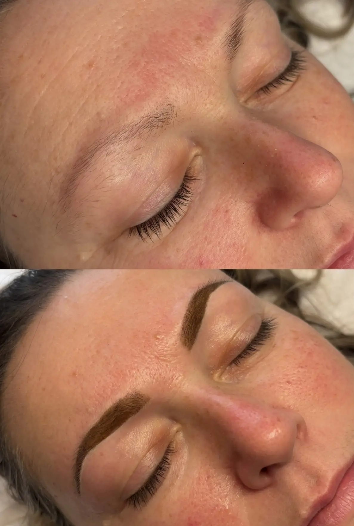 Esthetician Portfolio Photo