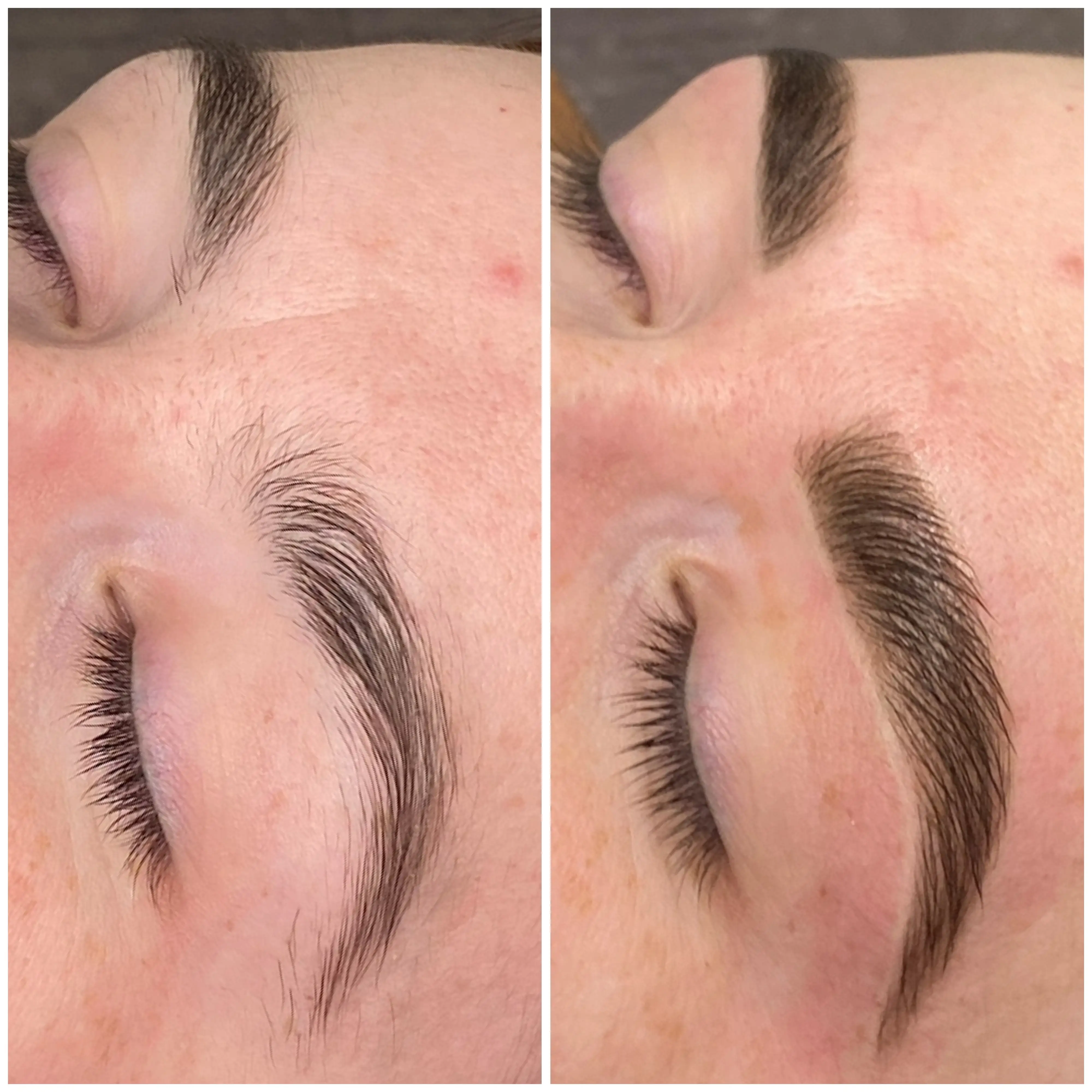 Esthetician Portfolio Photo