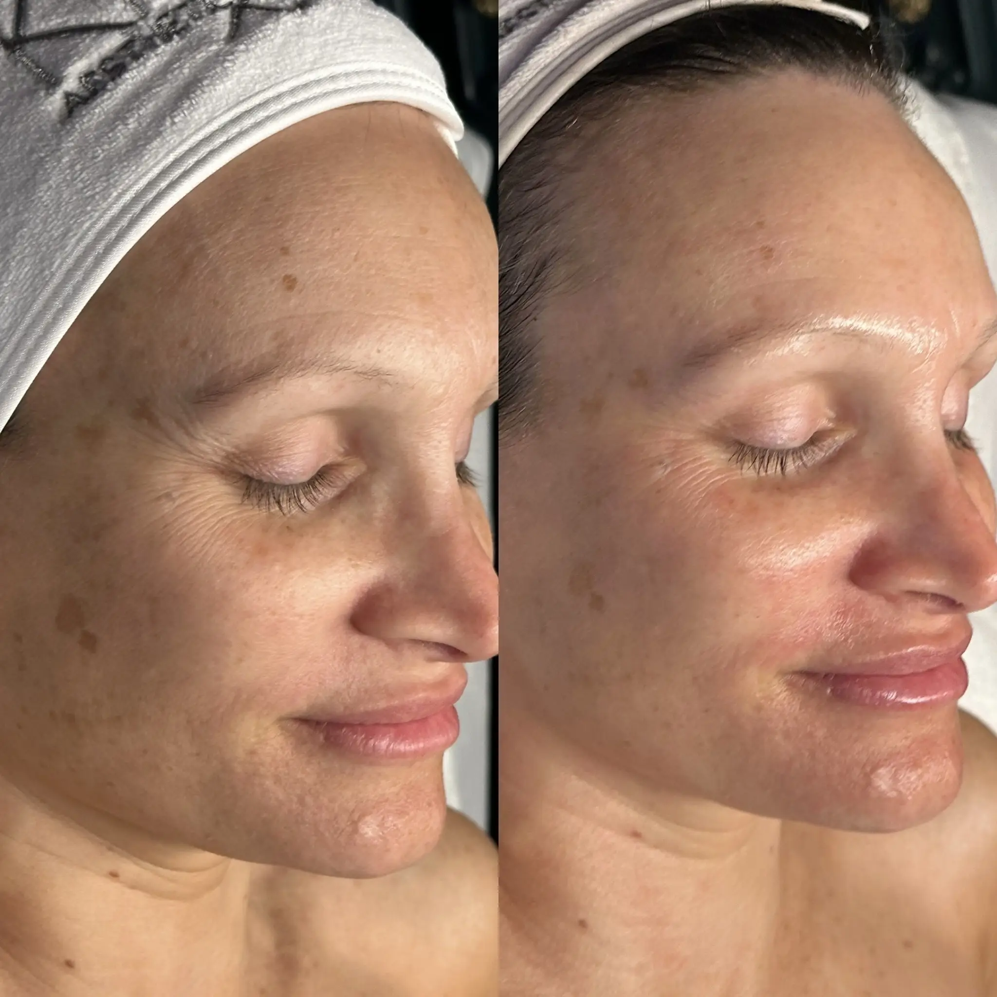 Esthetician Portfolio Photo