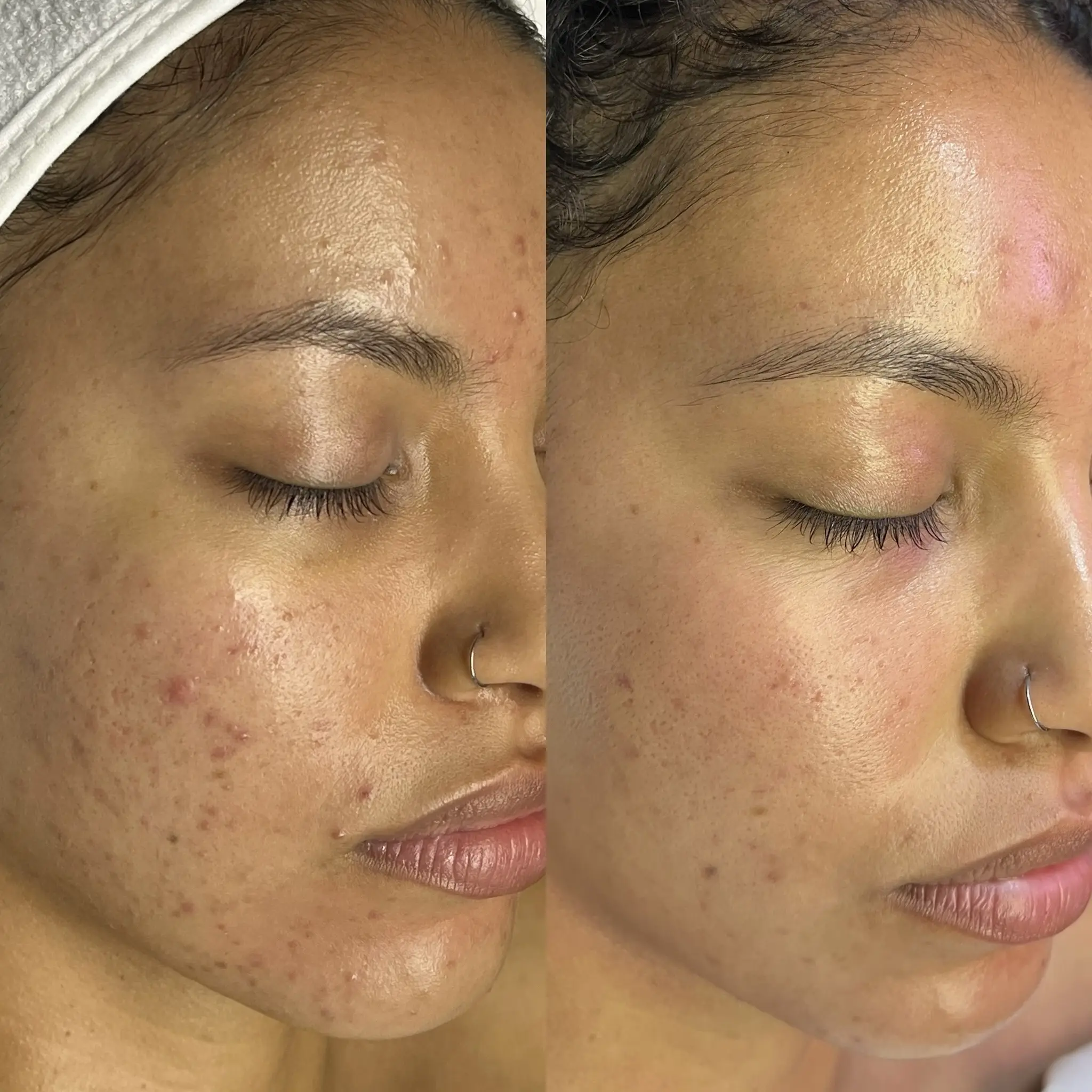 Esthetician Portfolio Photo