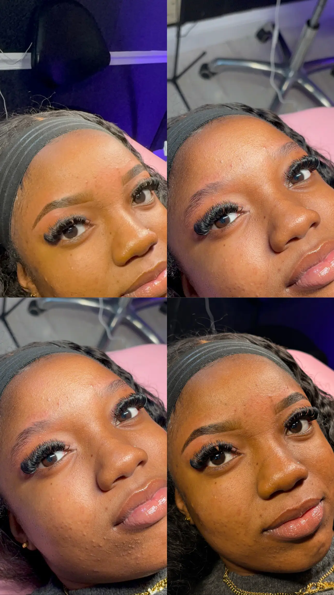 Esthetician Portfolio Photo