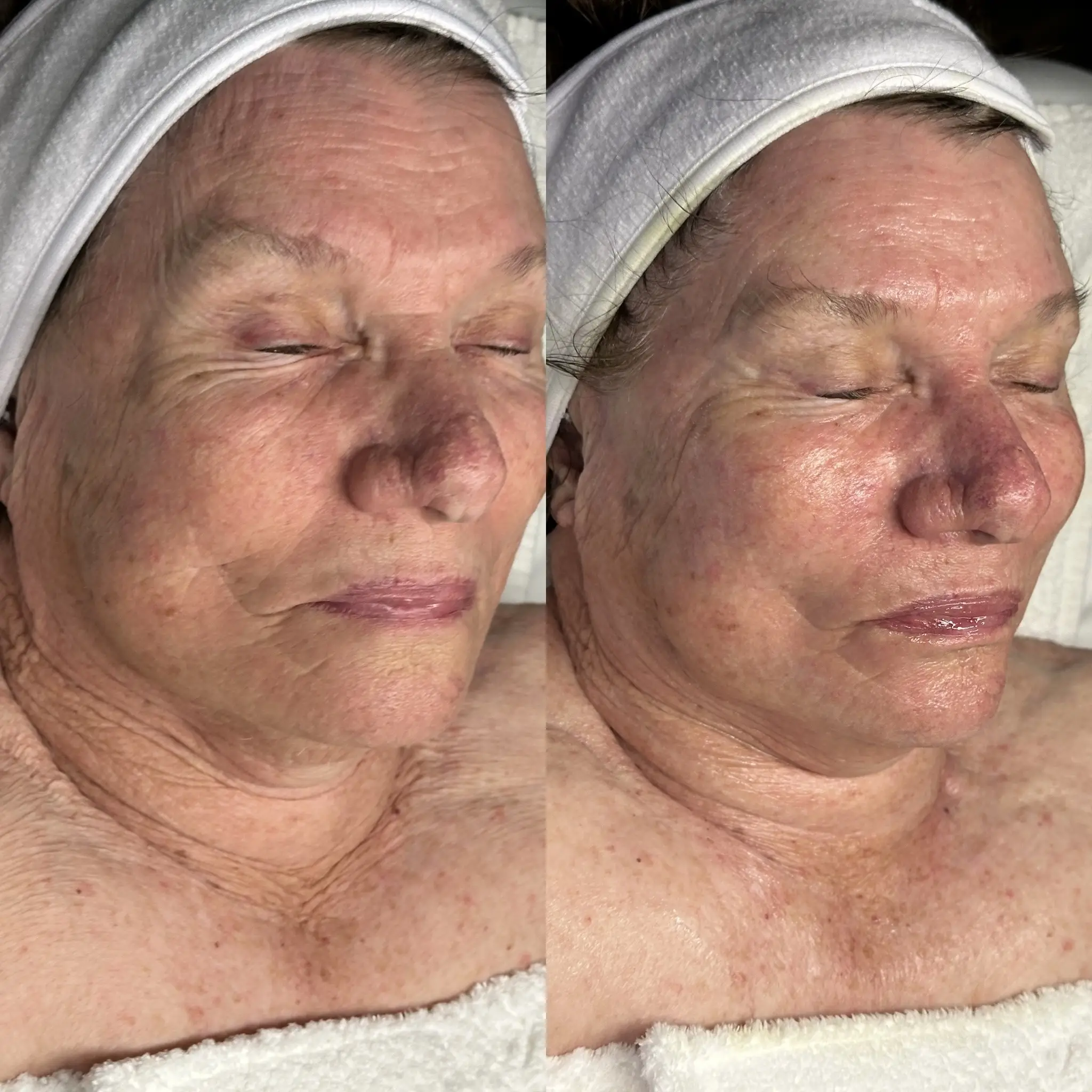 Esthetician Portfolio Photo