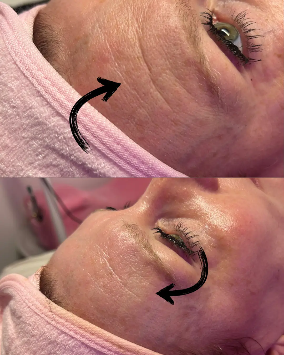 Esthetician Portfolio Photo