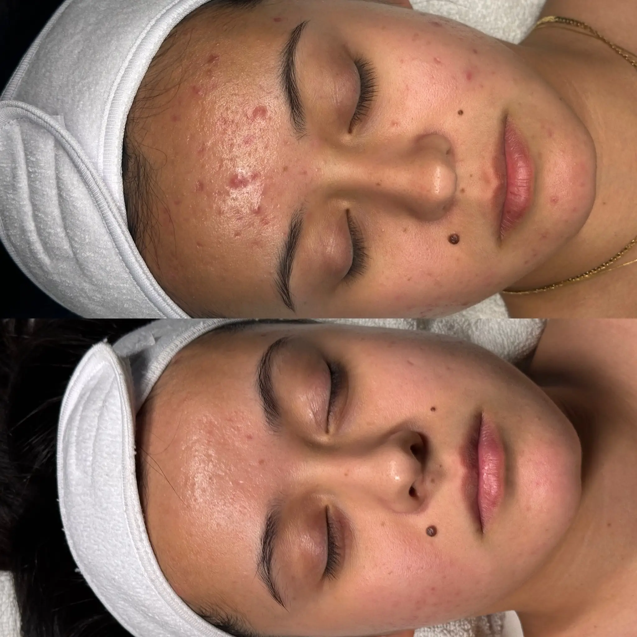 Esthetician Portfolio Photo