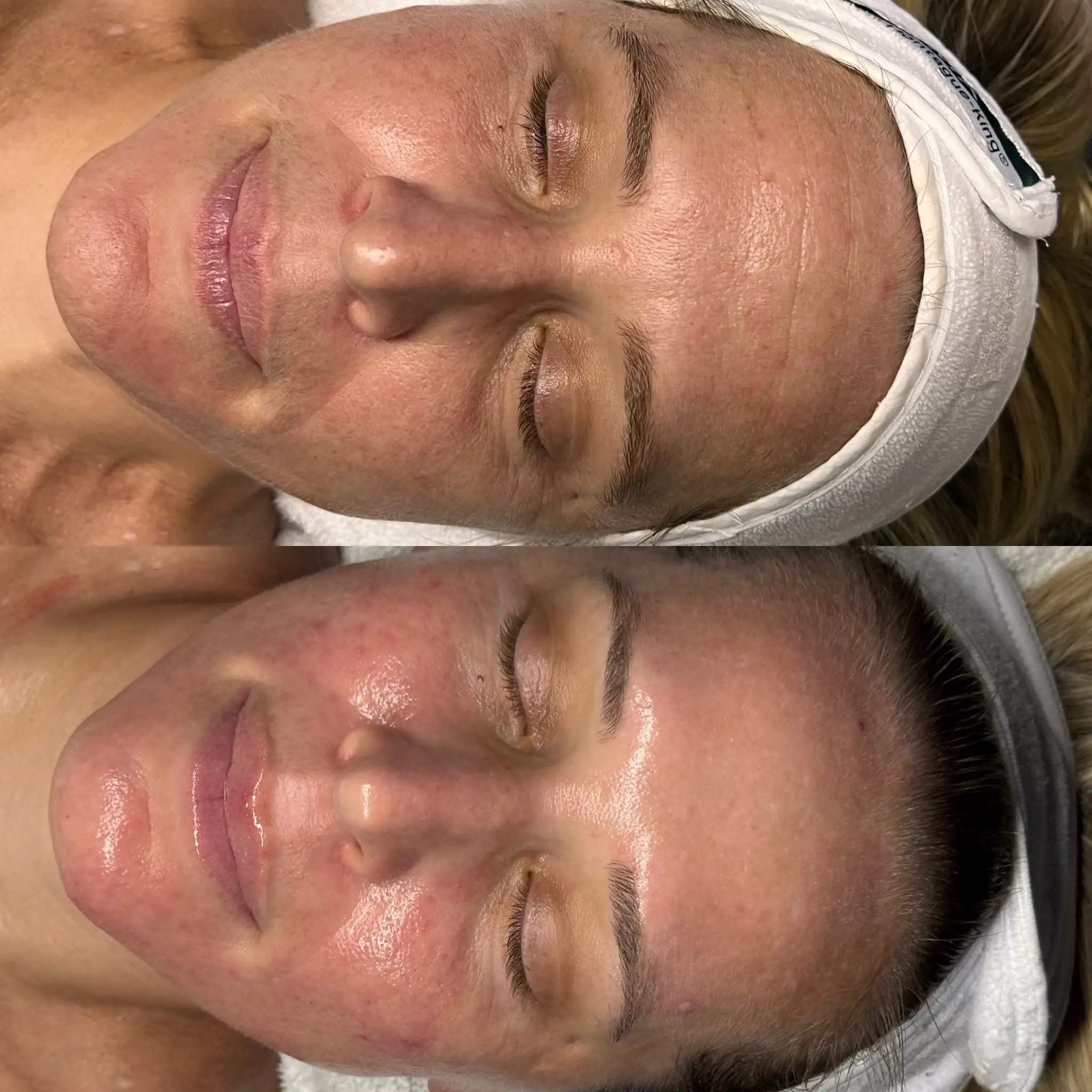 Esthetician Portfolio Photo