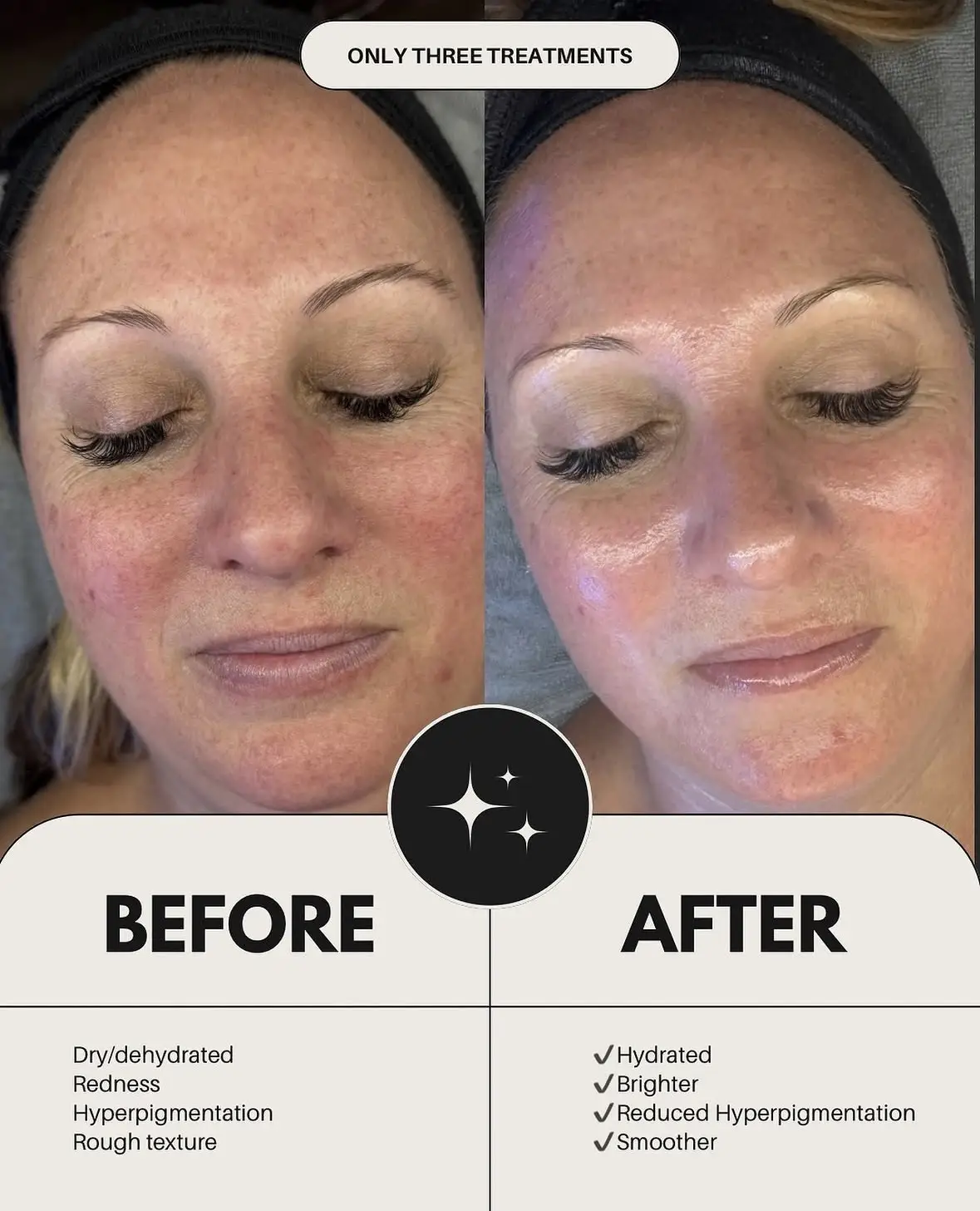 Deluxe K-Beauty Treatment