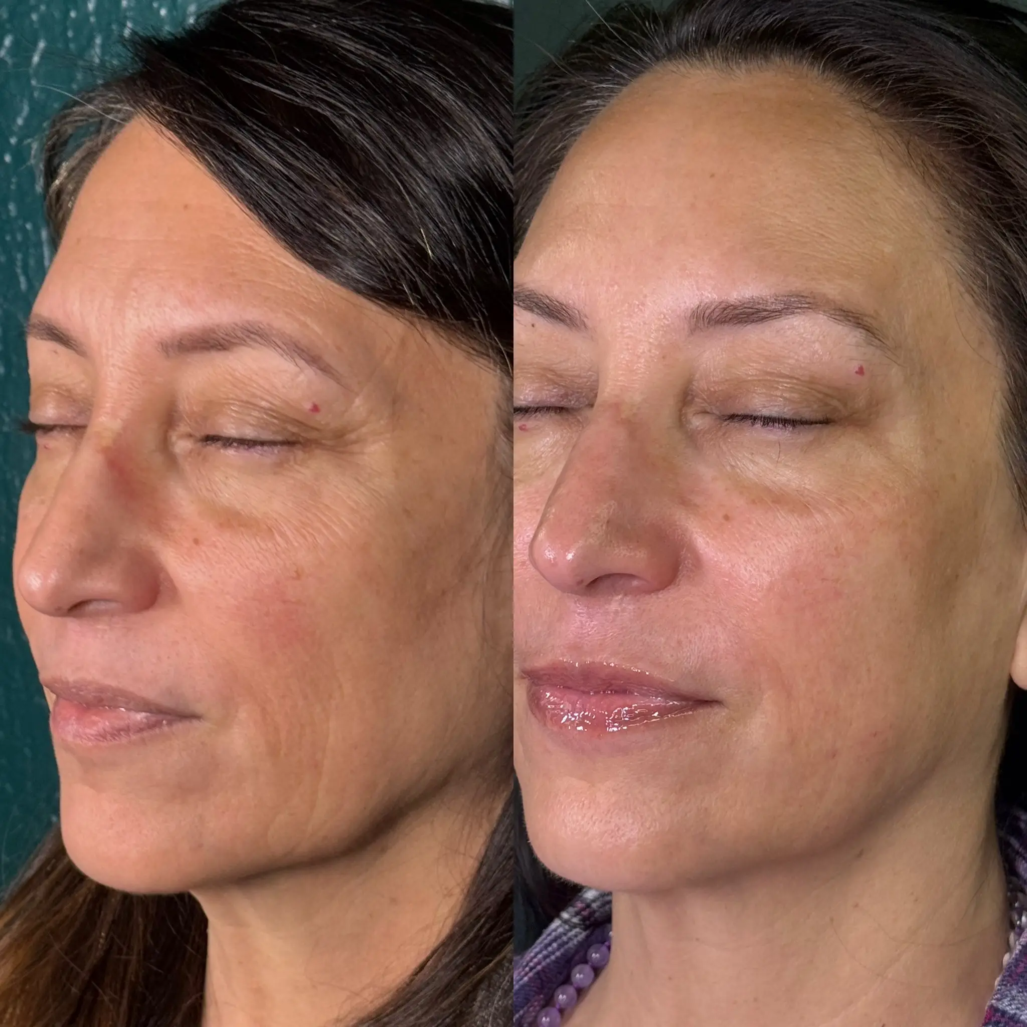 Esthetician Portfolio Photo