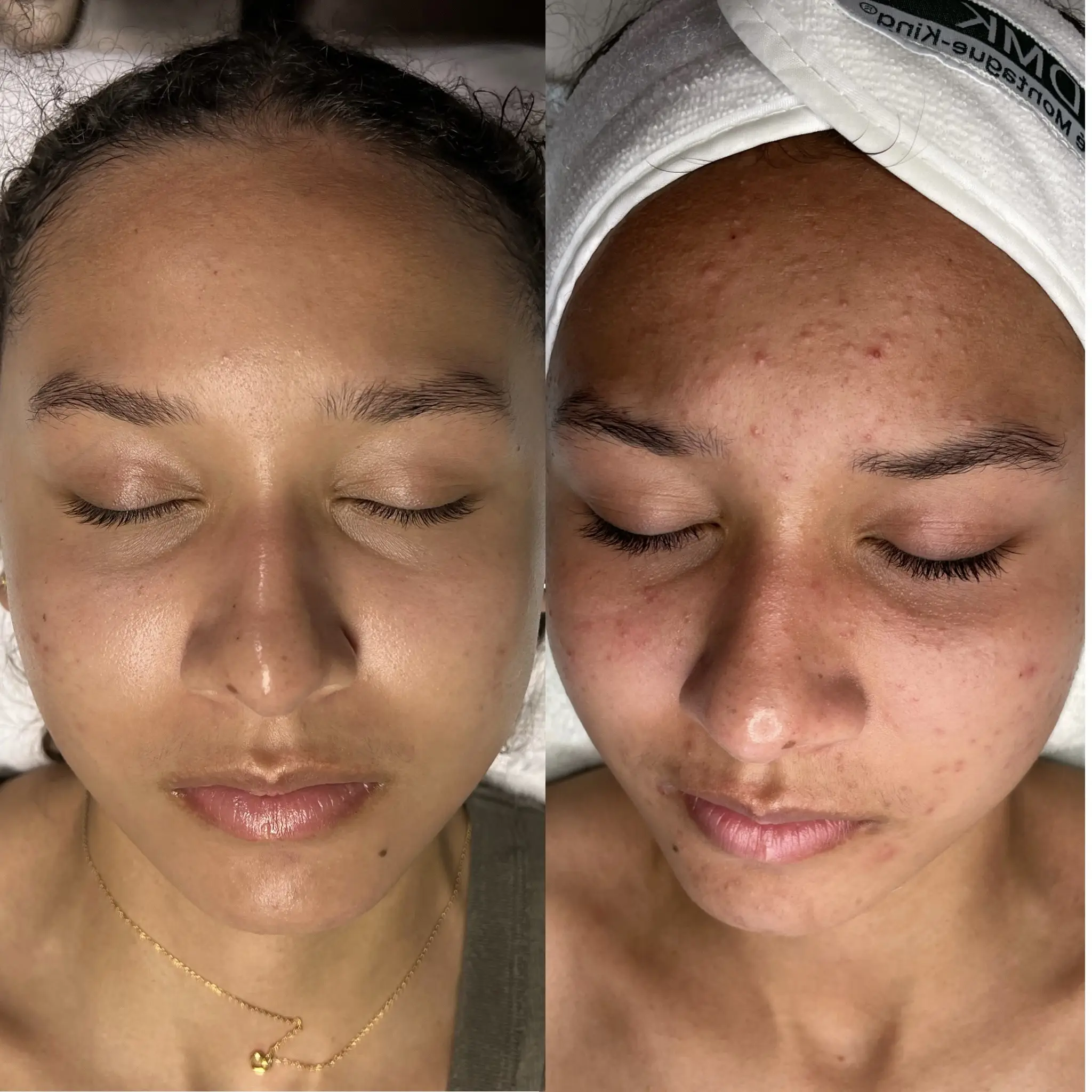 Esthetician Portfolio Photo