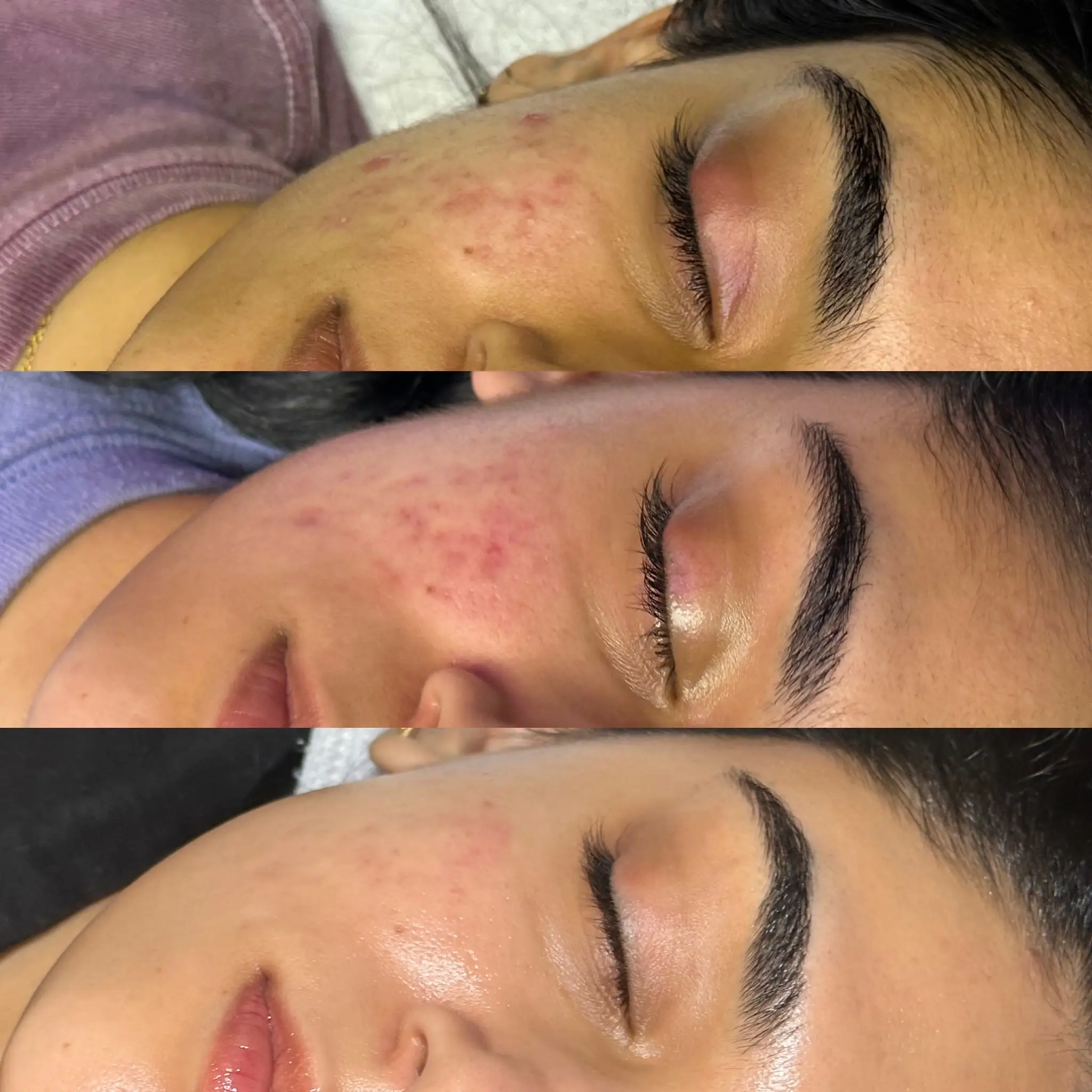 Esthetician Portfolio Photo
