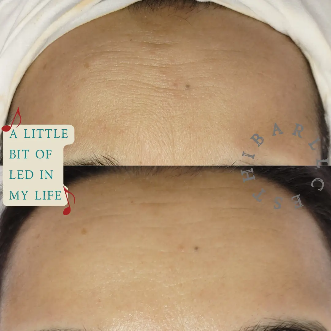 Esthetician Portfolio Photo