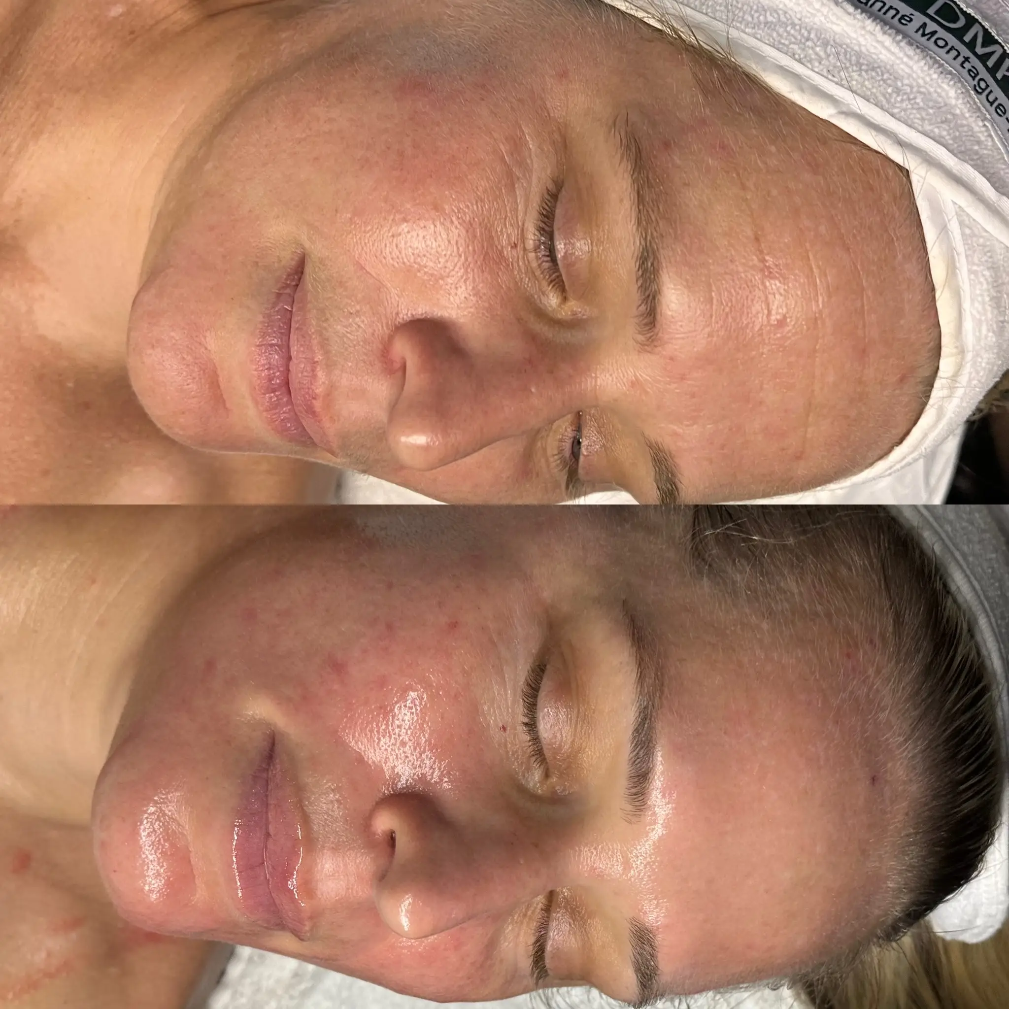 Esthetician Portfolio Photo