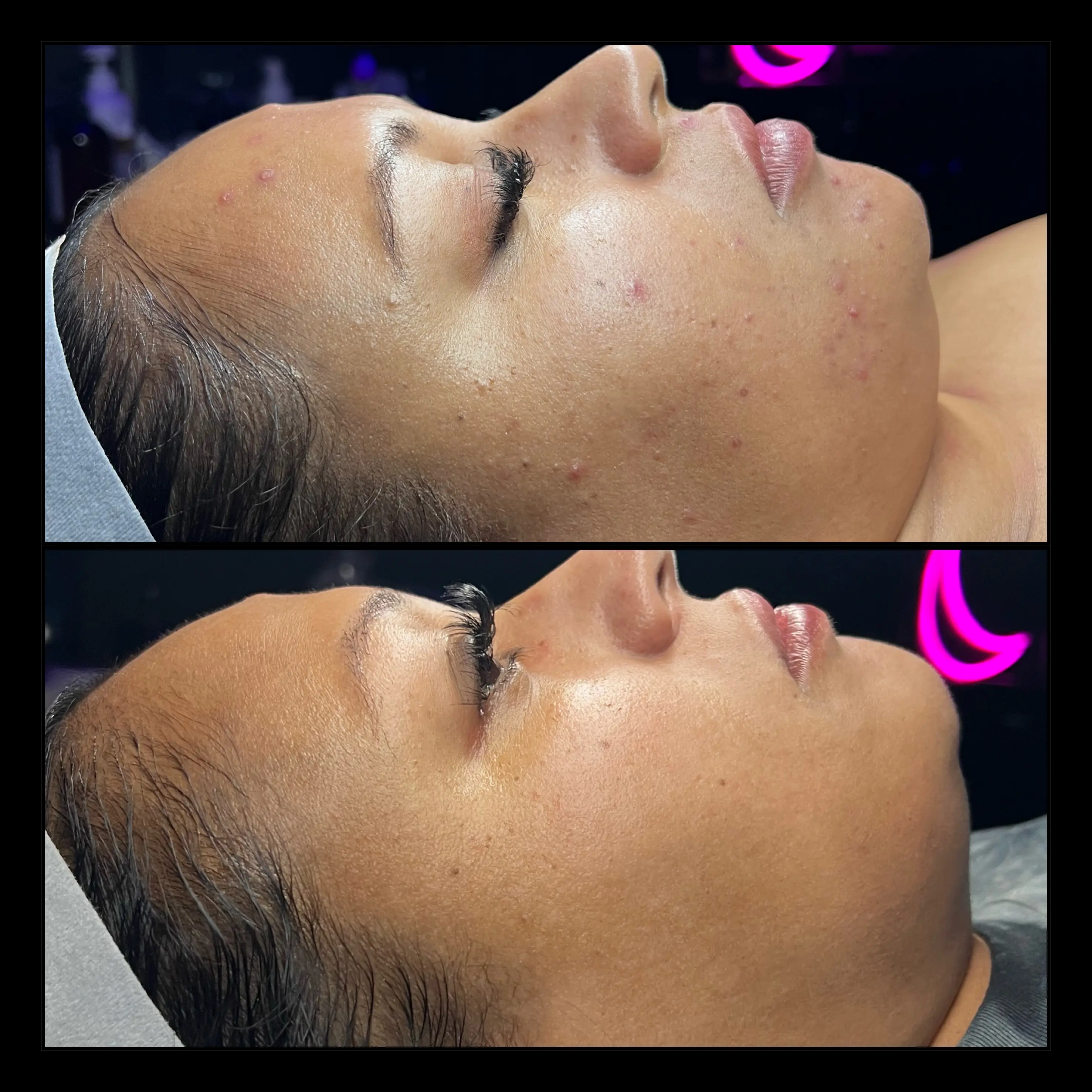Work by Amethyst Skin Clinic