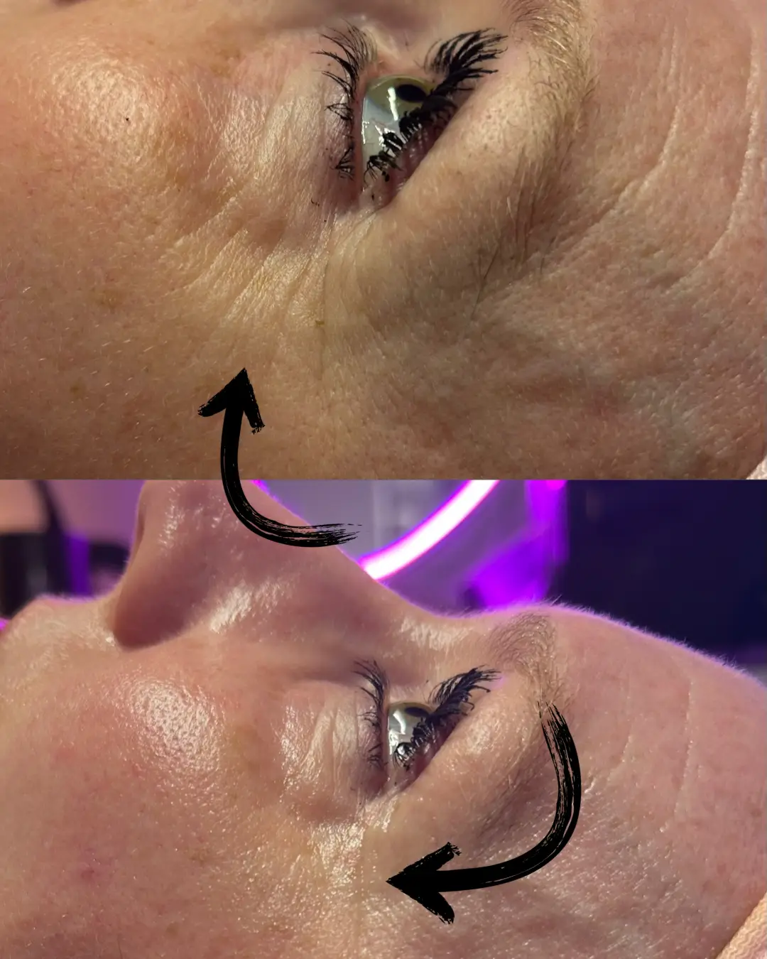 Esthetician Portfolio Photo