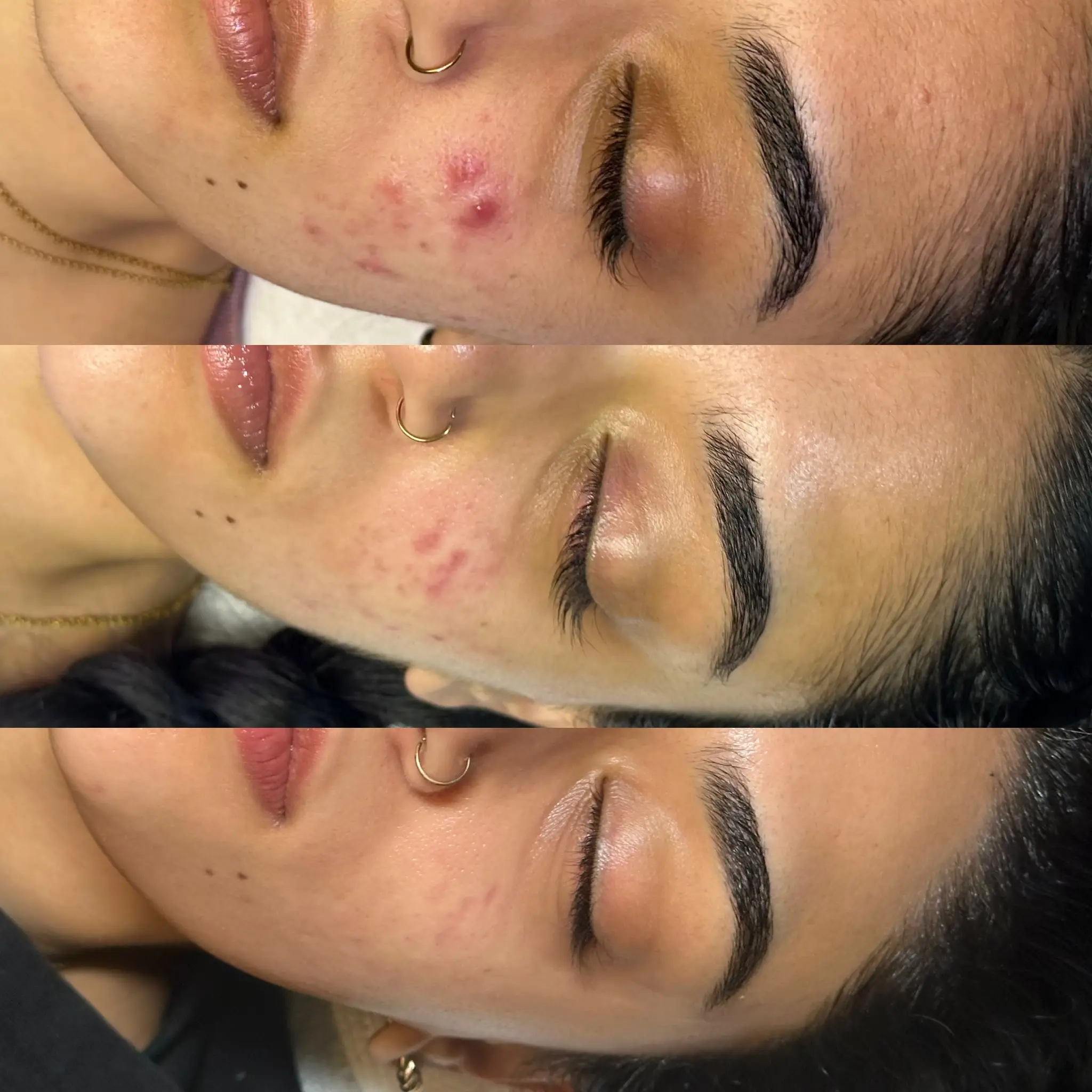 Esthetician Portfolio Photo