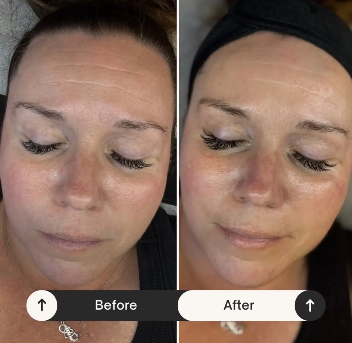 Deluxe K-Beauty Treatment