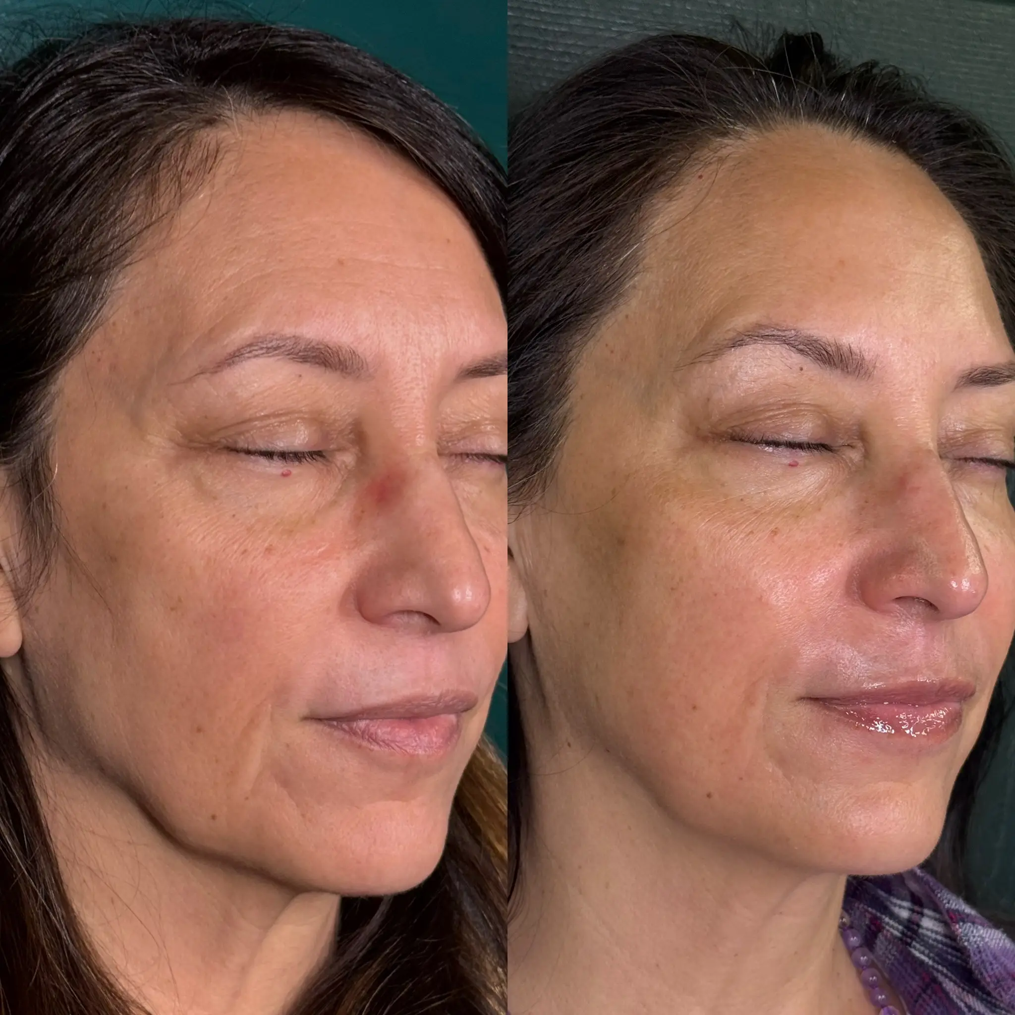 Esthetician Portfolio Photo