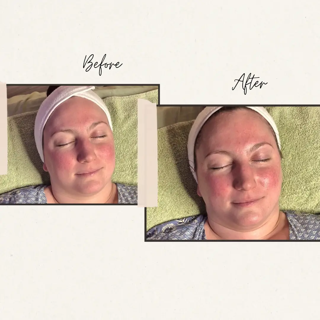 Esthetician Portfolio Photo