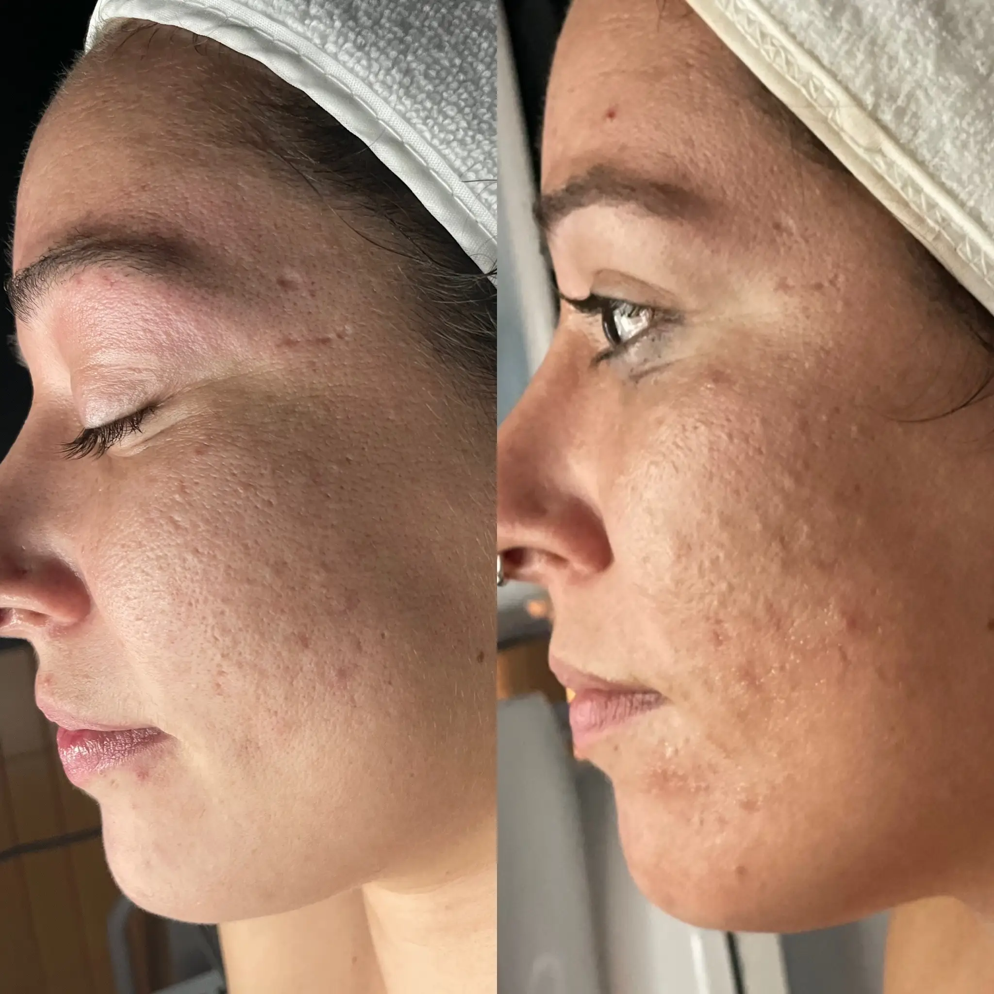 Esthetician Portfolio Photo