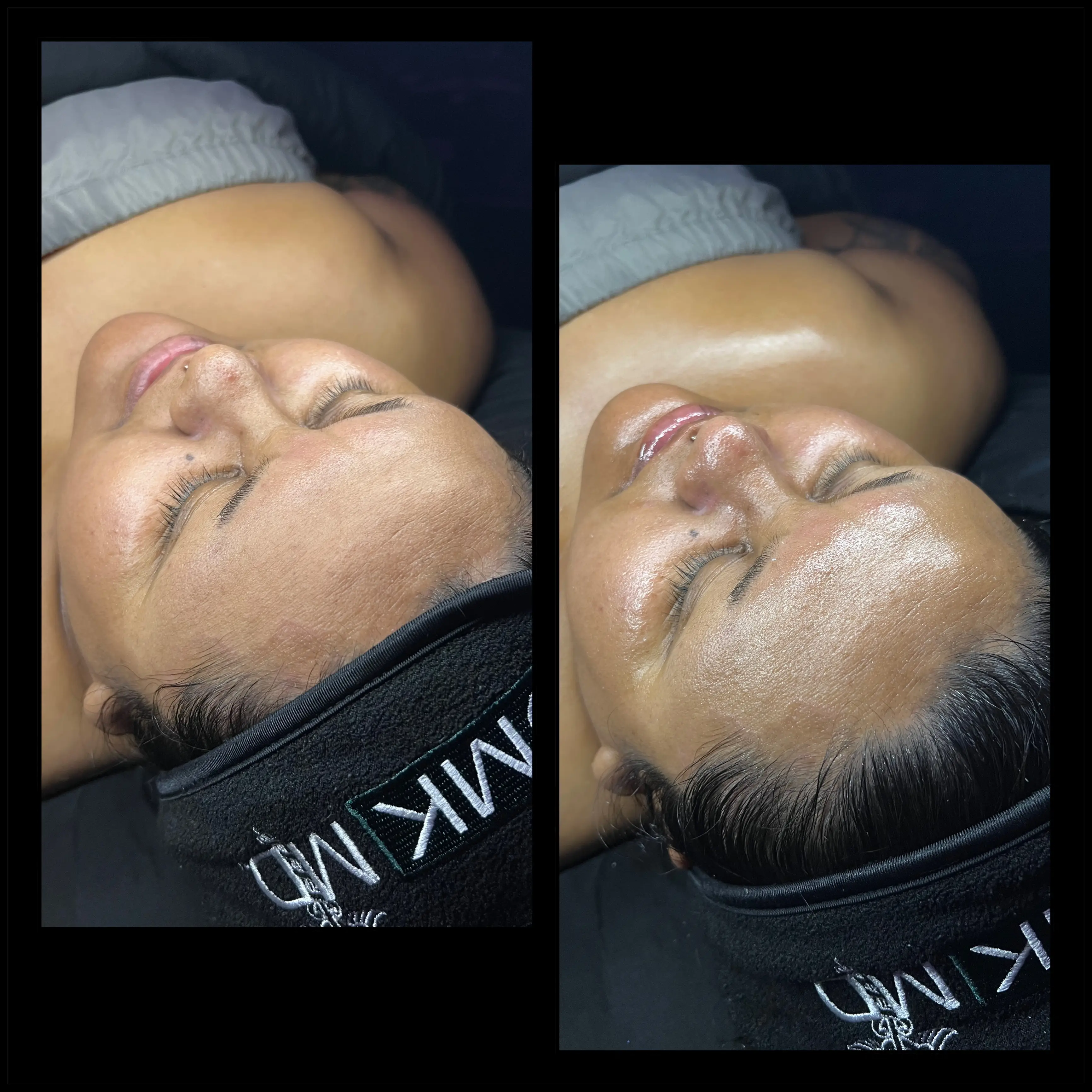 Work by Amethyst Skin Clinic