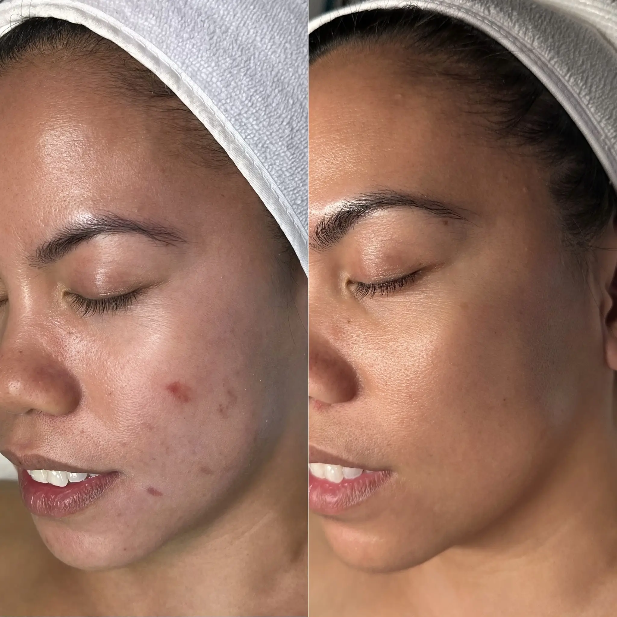 Esthetician Portfolio Photo