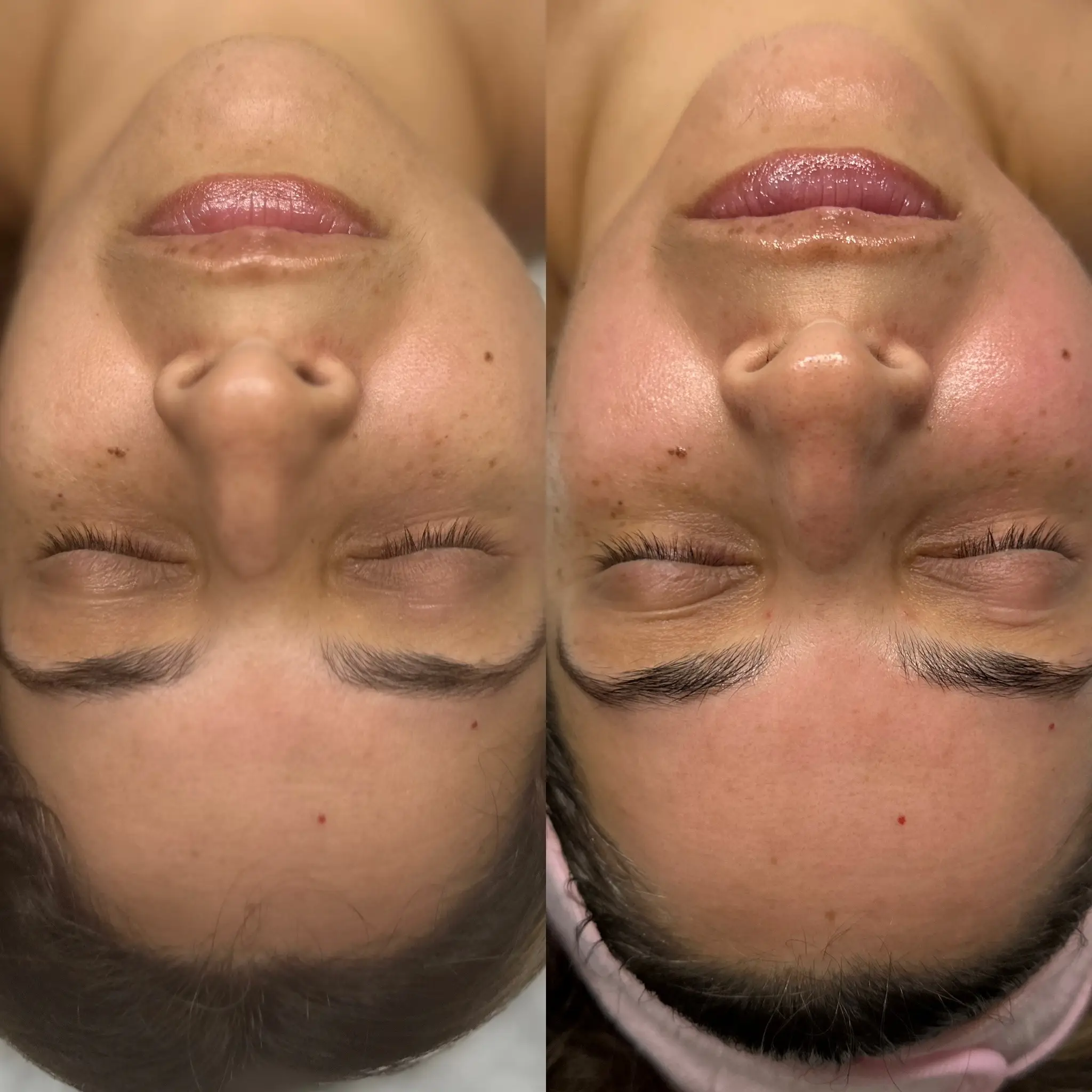 VÉRA Method