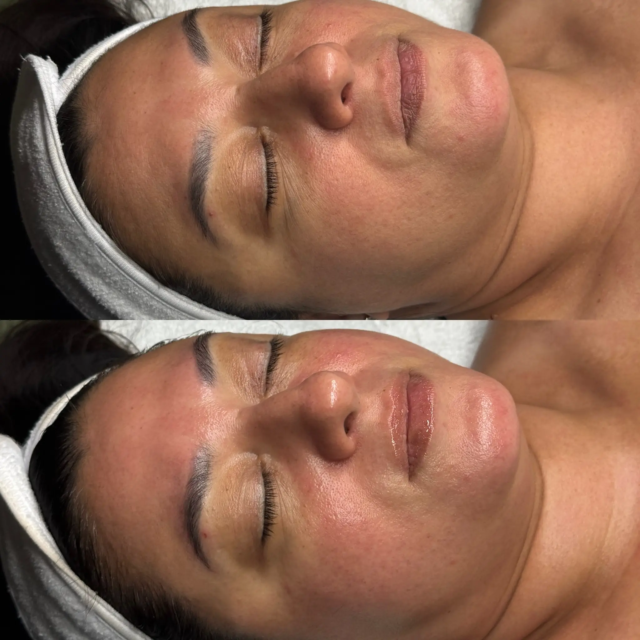 Esthetician Portfolio Photo