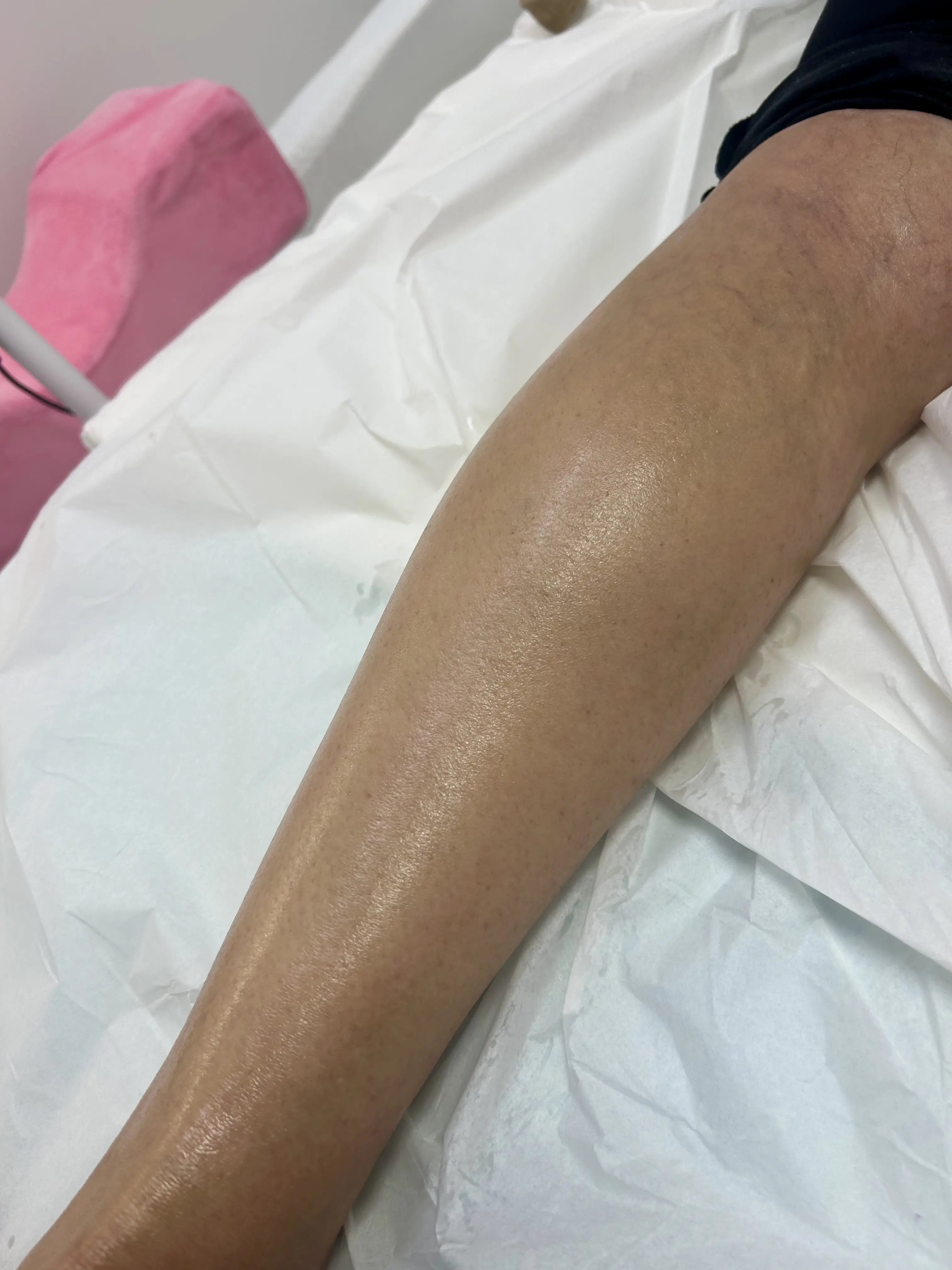 Esthetician Portfolio Photo