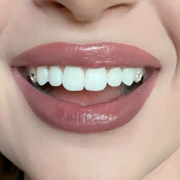 Work by Dollhouse Esthetics