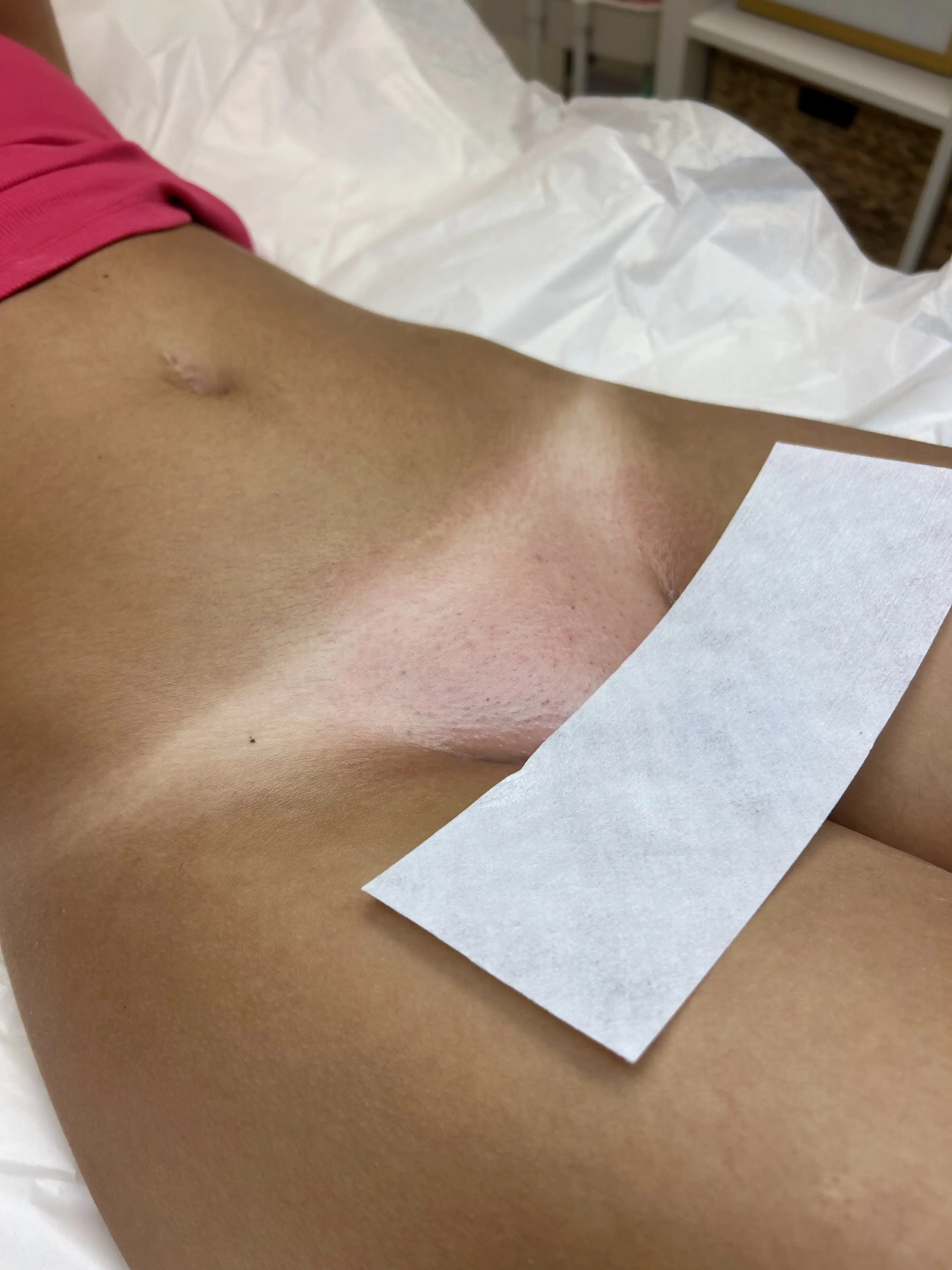 Esthetician Portfolio Photo