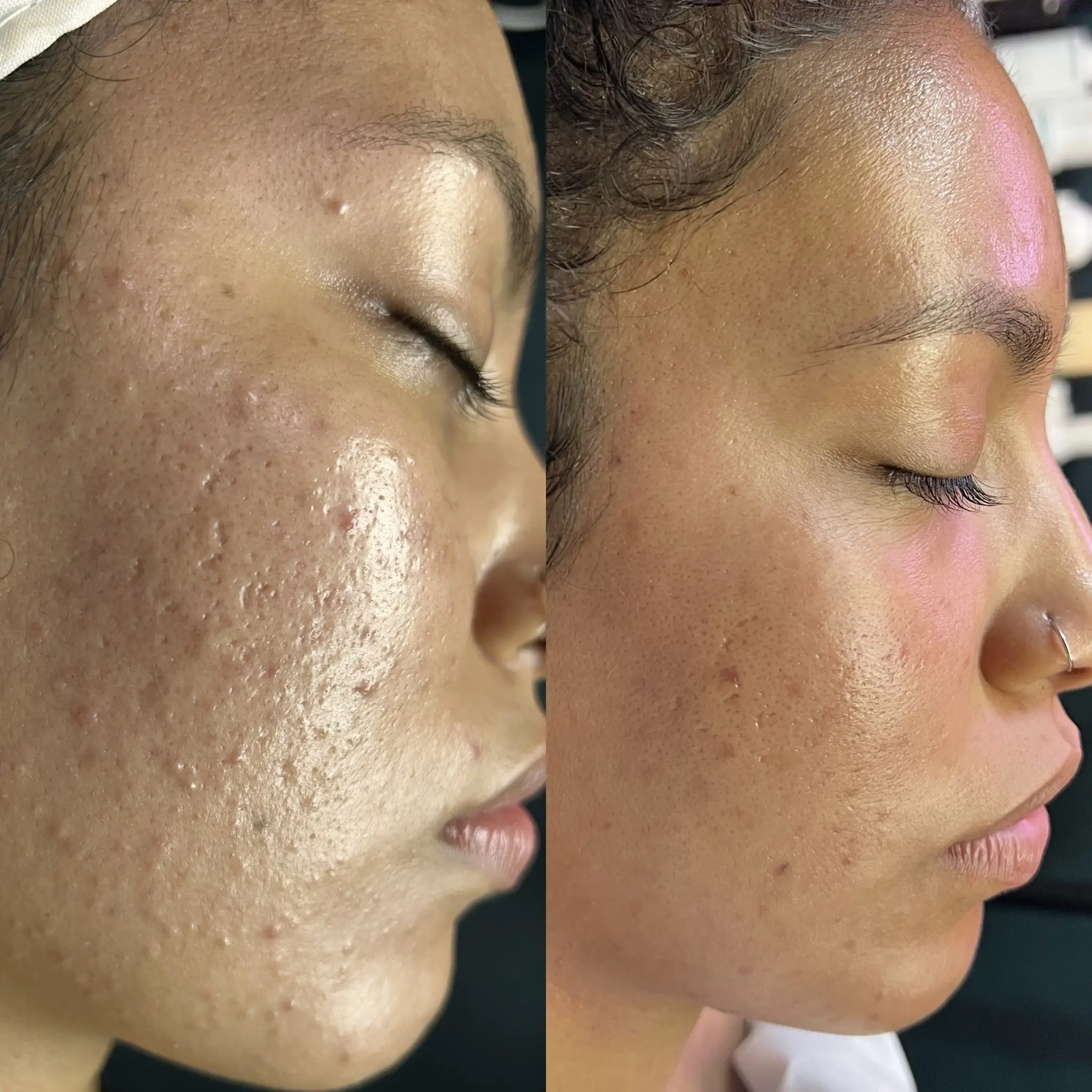Esthetician Portfolio Photo