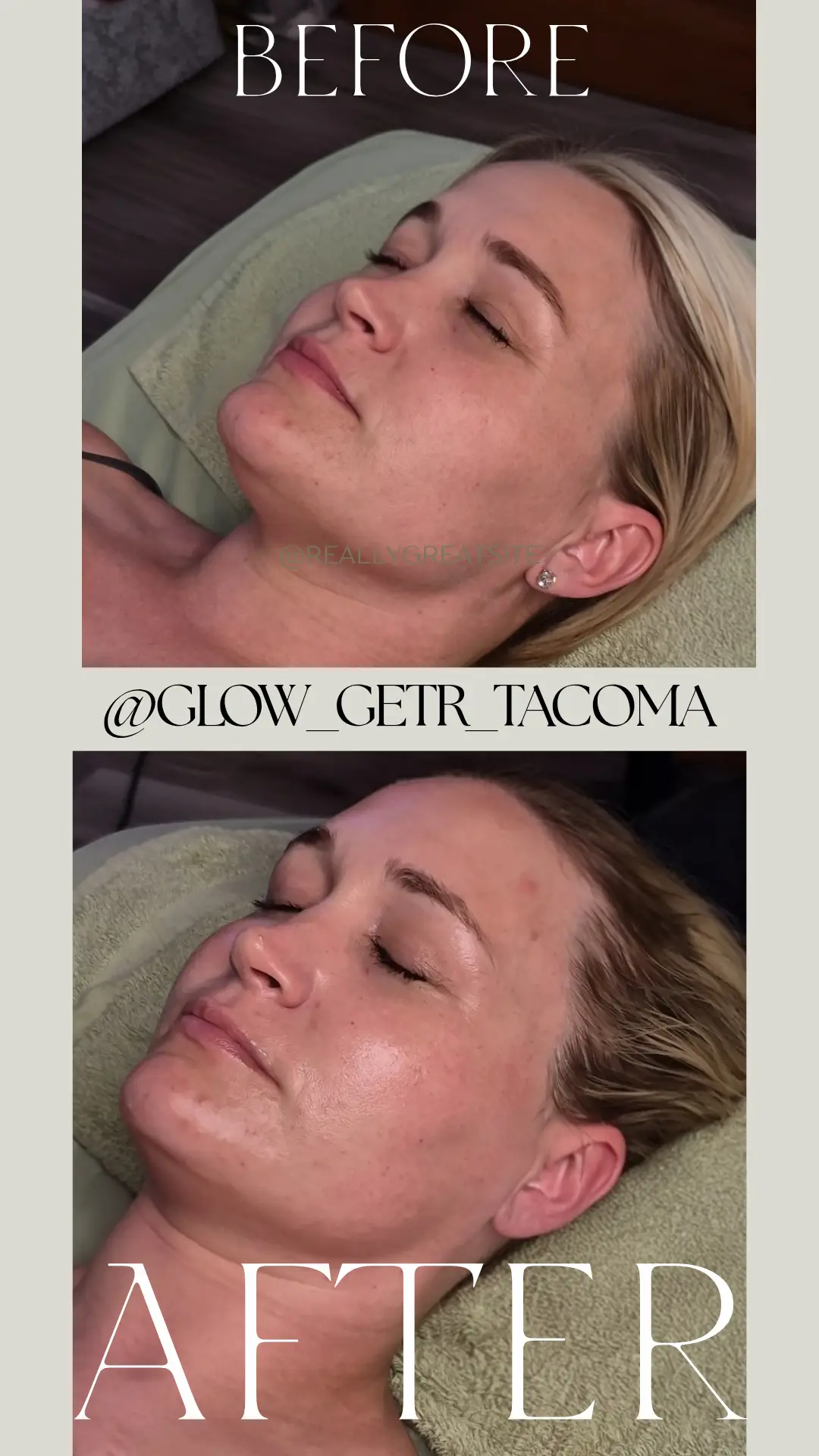 Esthetician Portfolio Photo