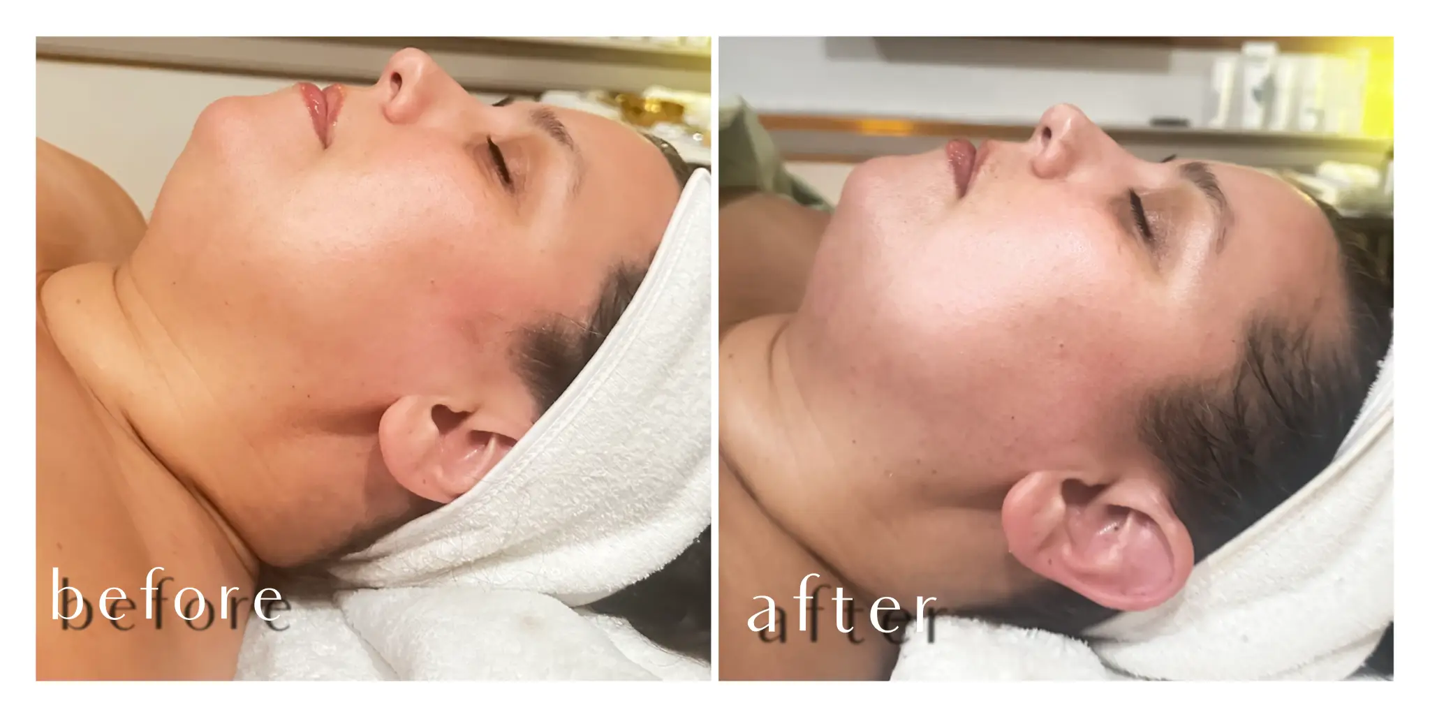 Waxing Specialist Portfolio Photo