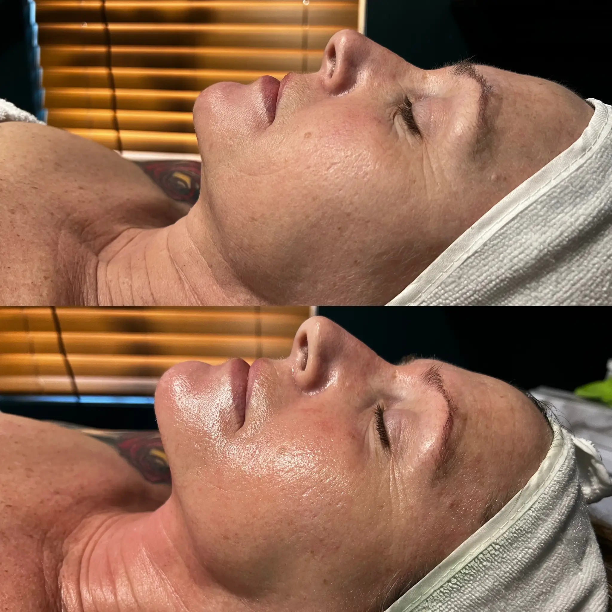 Esthetician Portfolio Photo