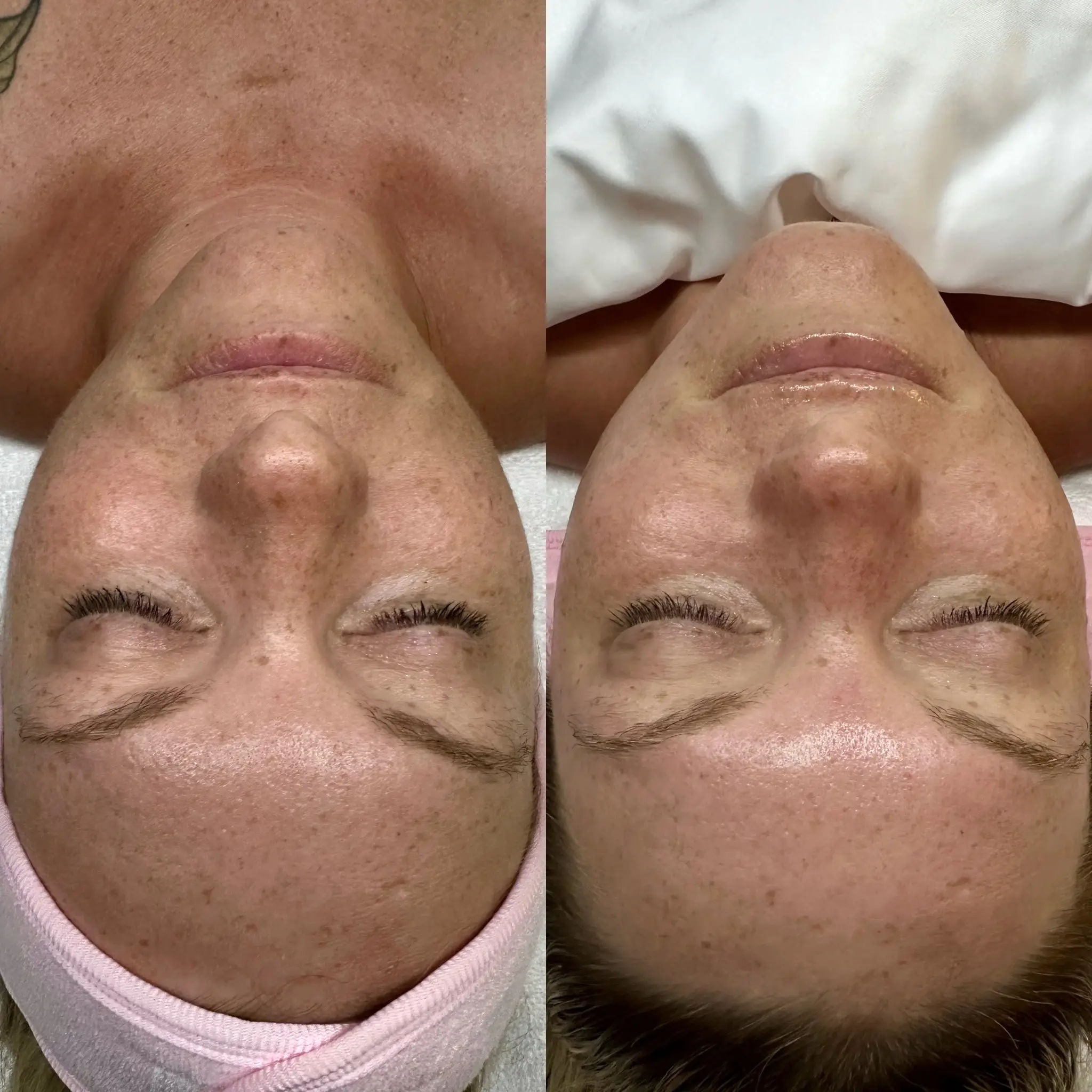 VÉRA Smooth | Dermaplane 