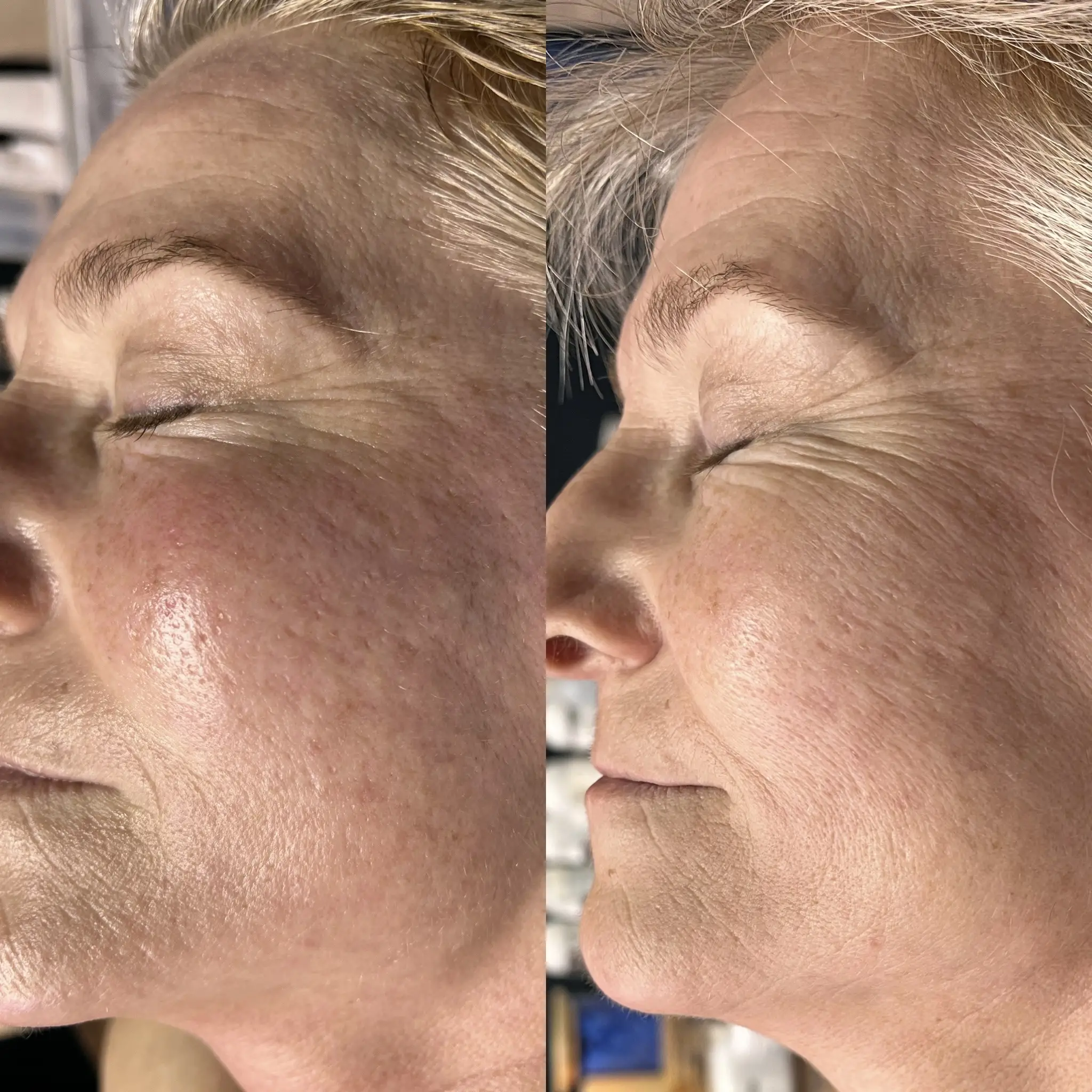 Esthetician Portfolio Photo