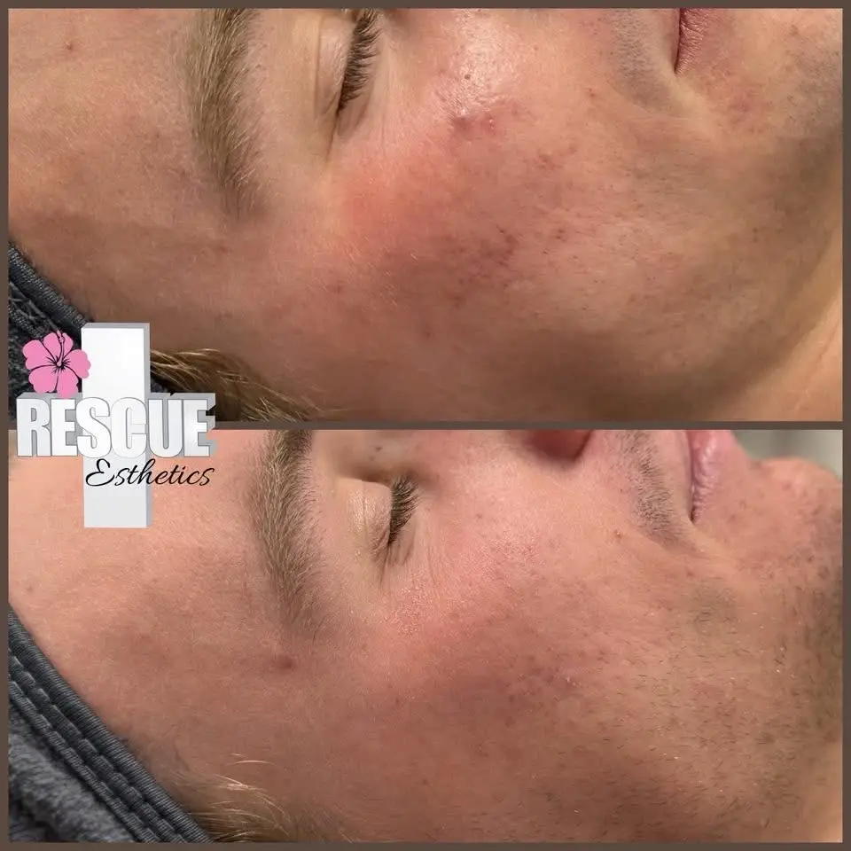 Esthetician Portfolio Photo