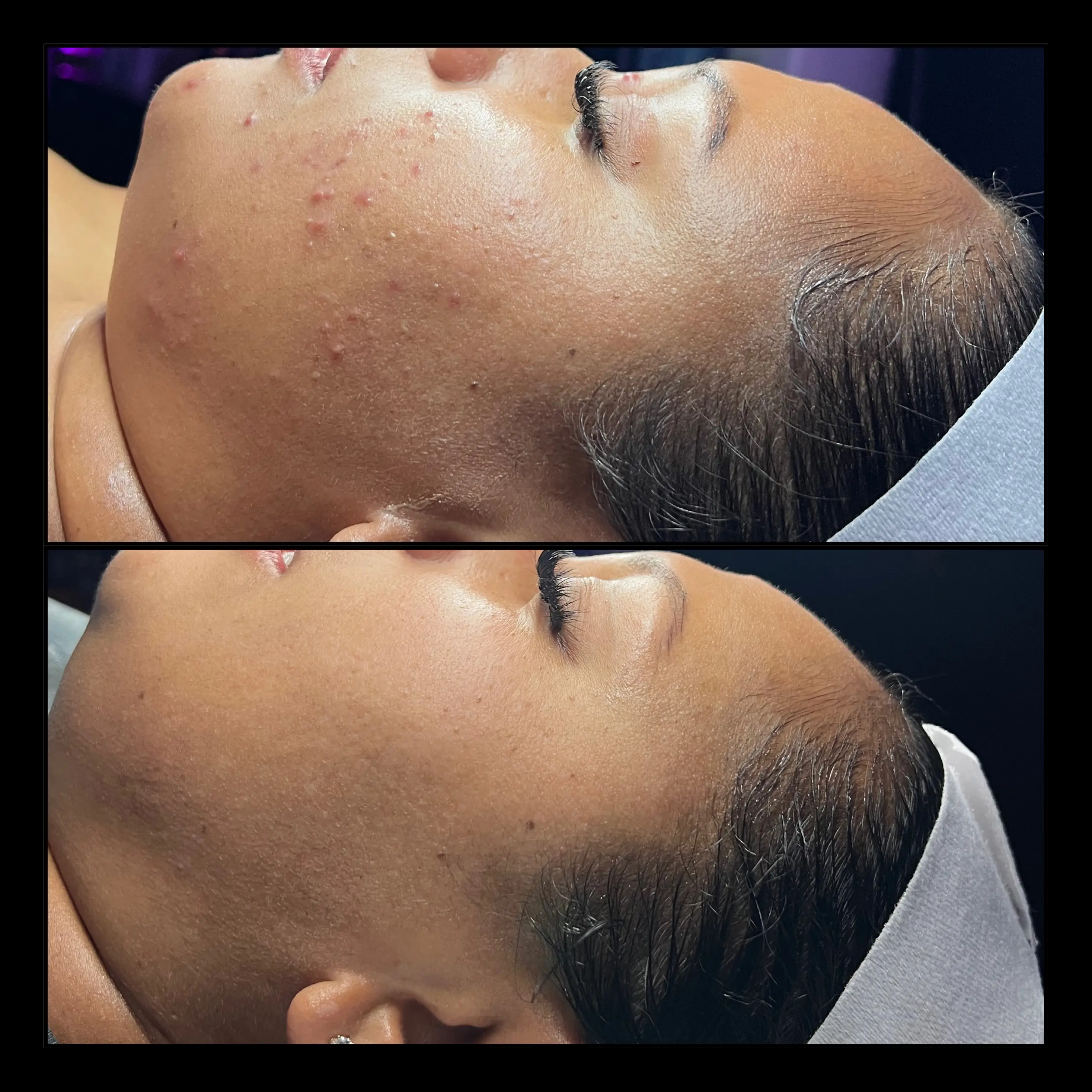 Work by Amethyst Skin Clinic