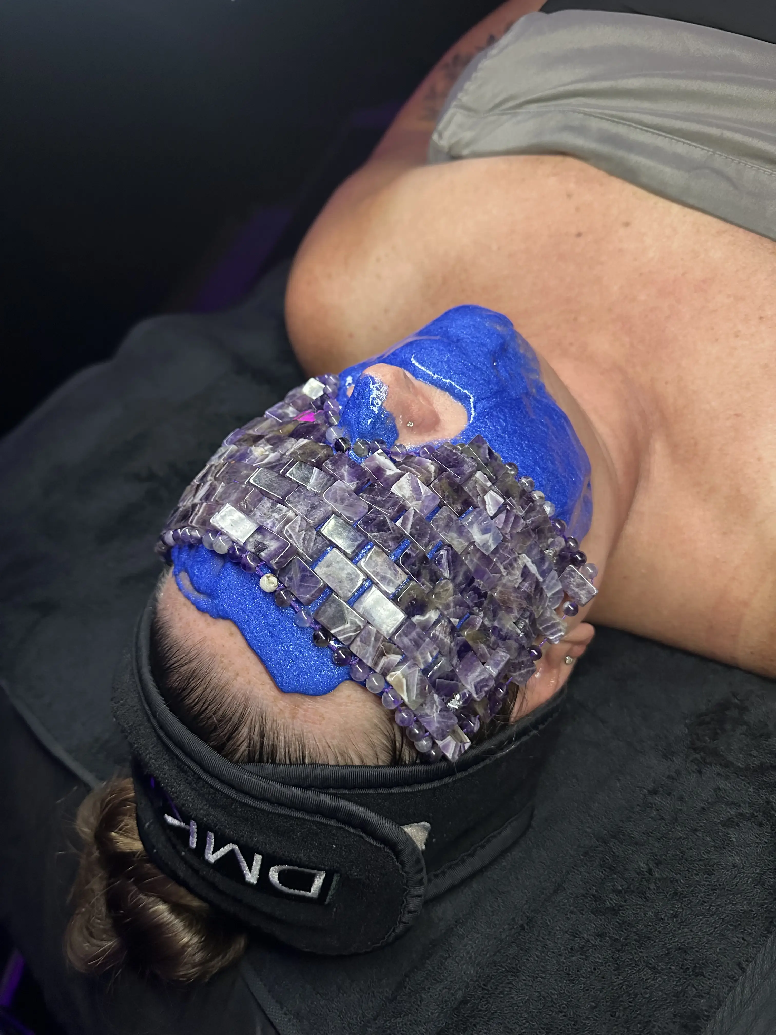 Work by Amethyst Skin Clinic