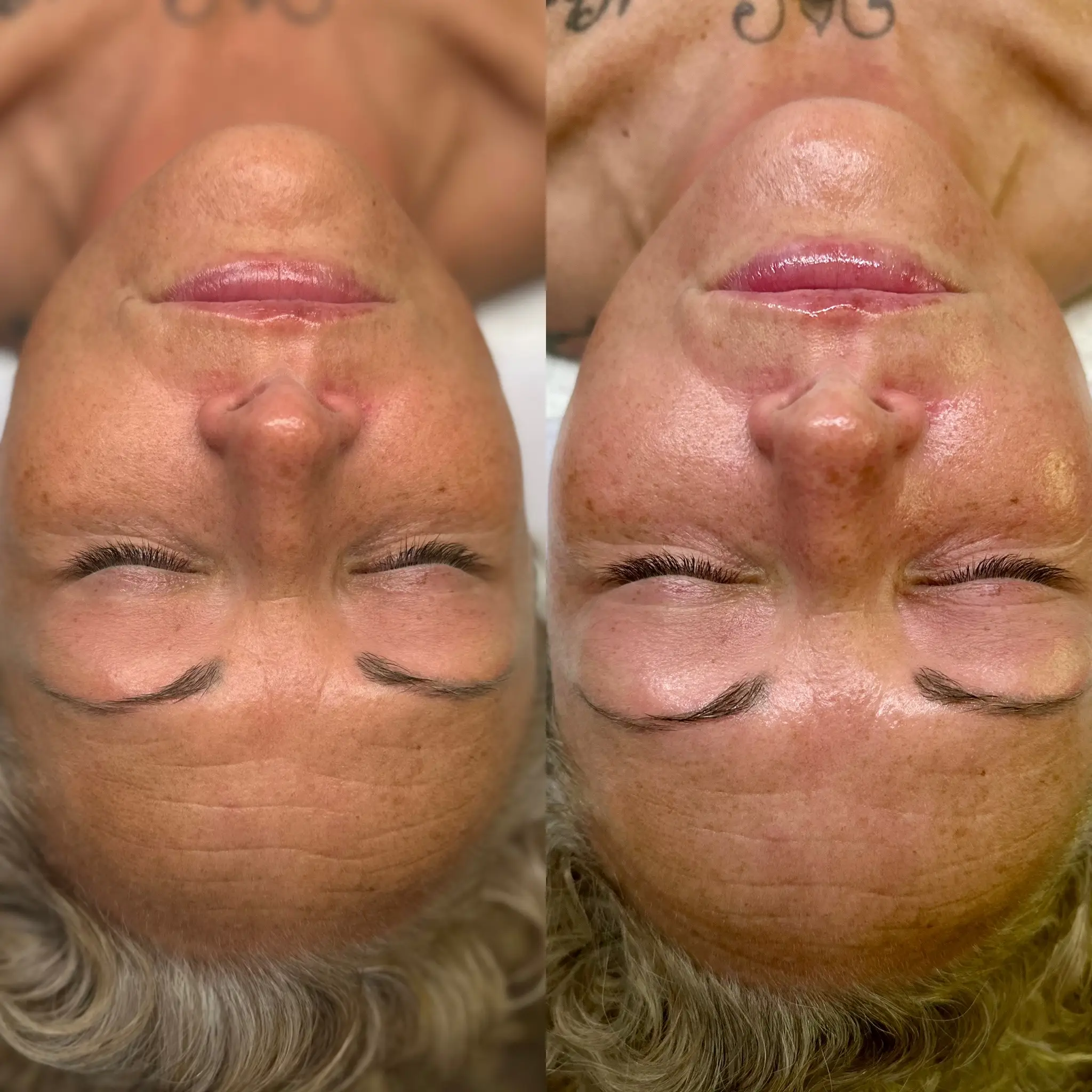 VÉRA Method