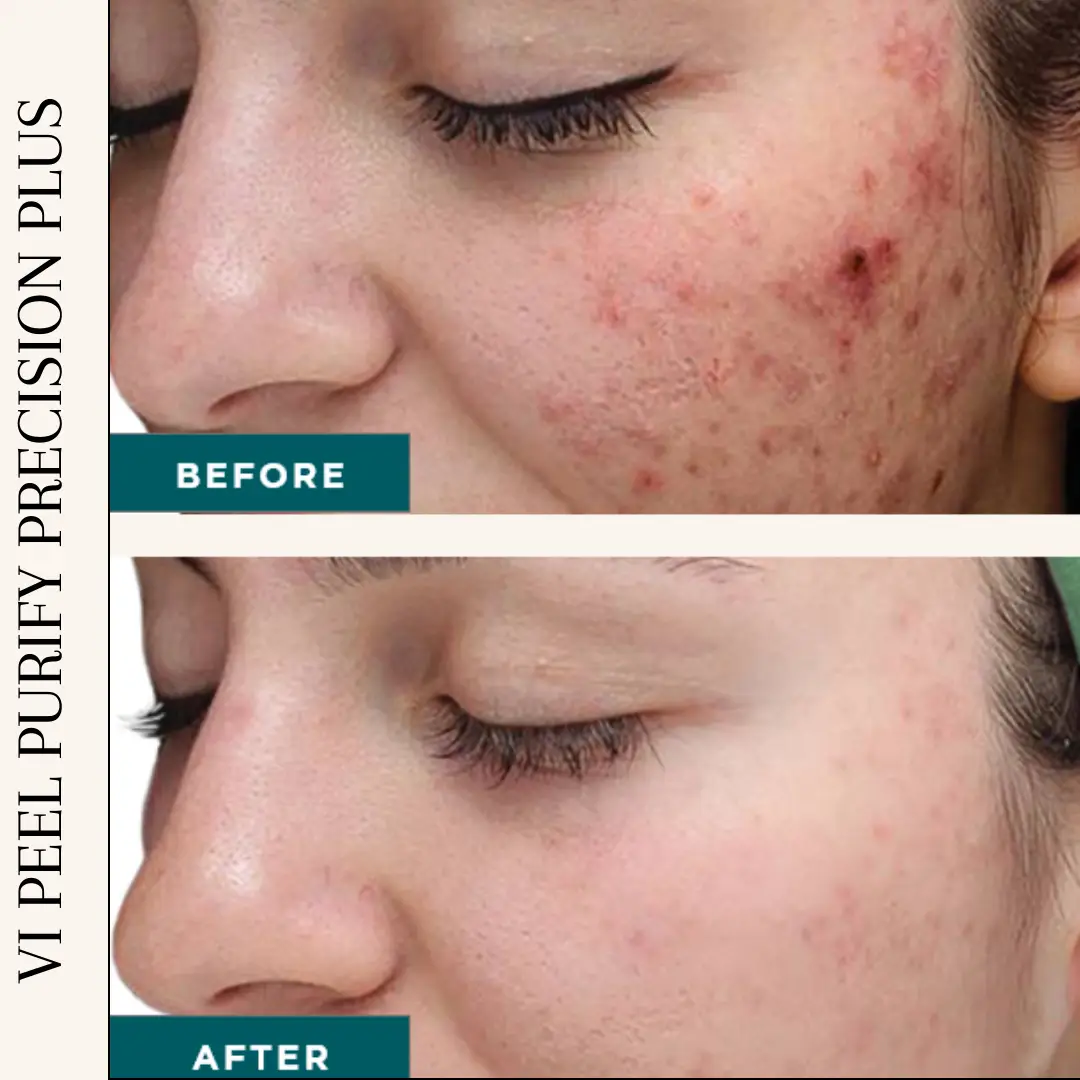 Esthetician Portfolio Photo