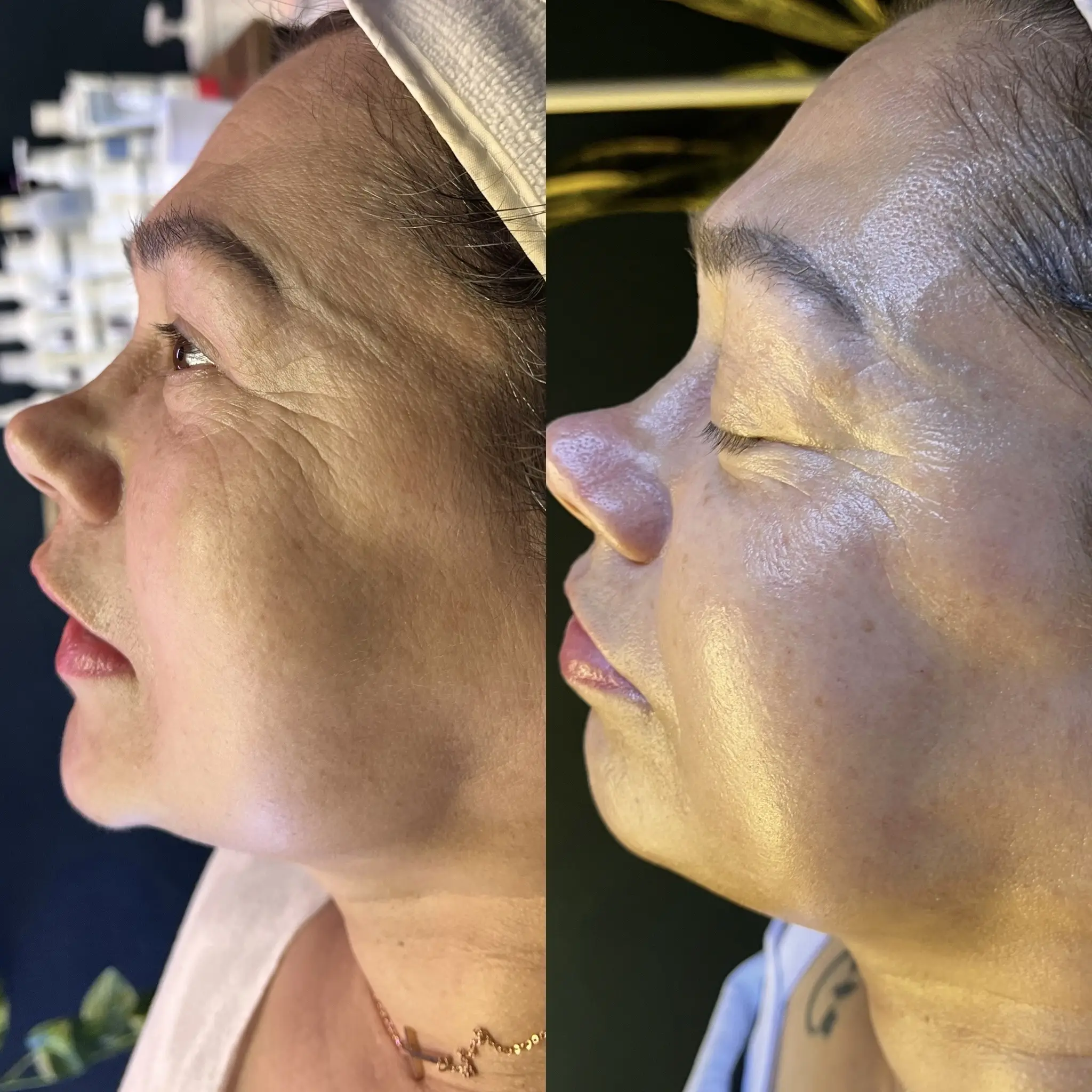 Esthetician Portfolio Photo