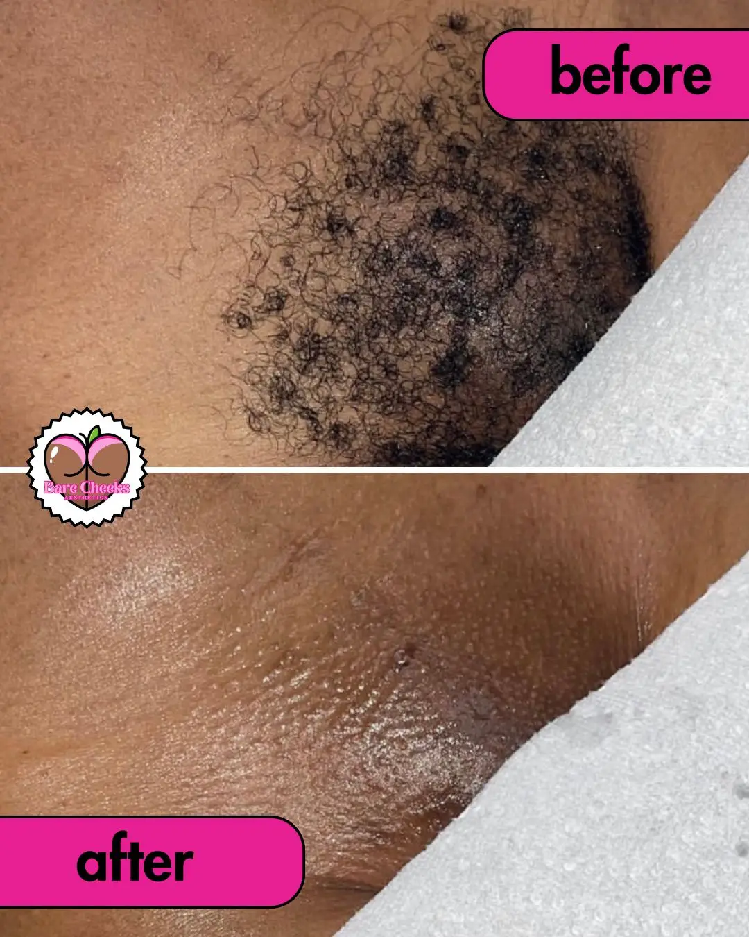 Work by Bare Cheeks Aesthetics