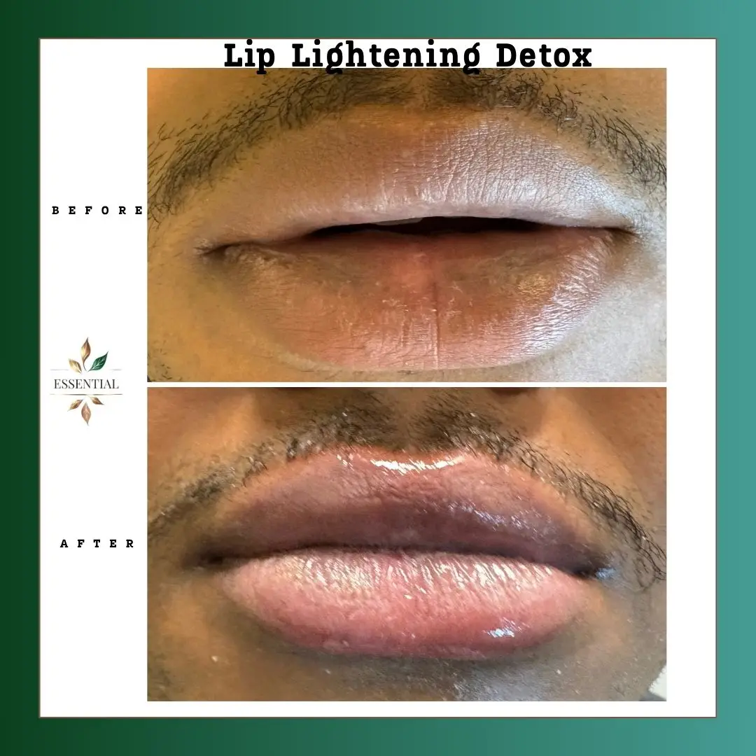 Esthetician Portfolio Photo