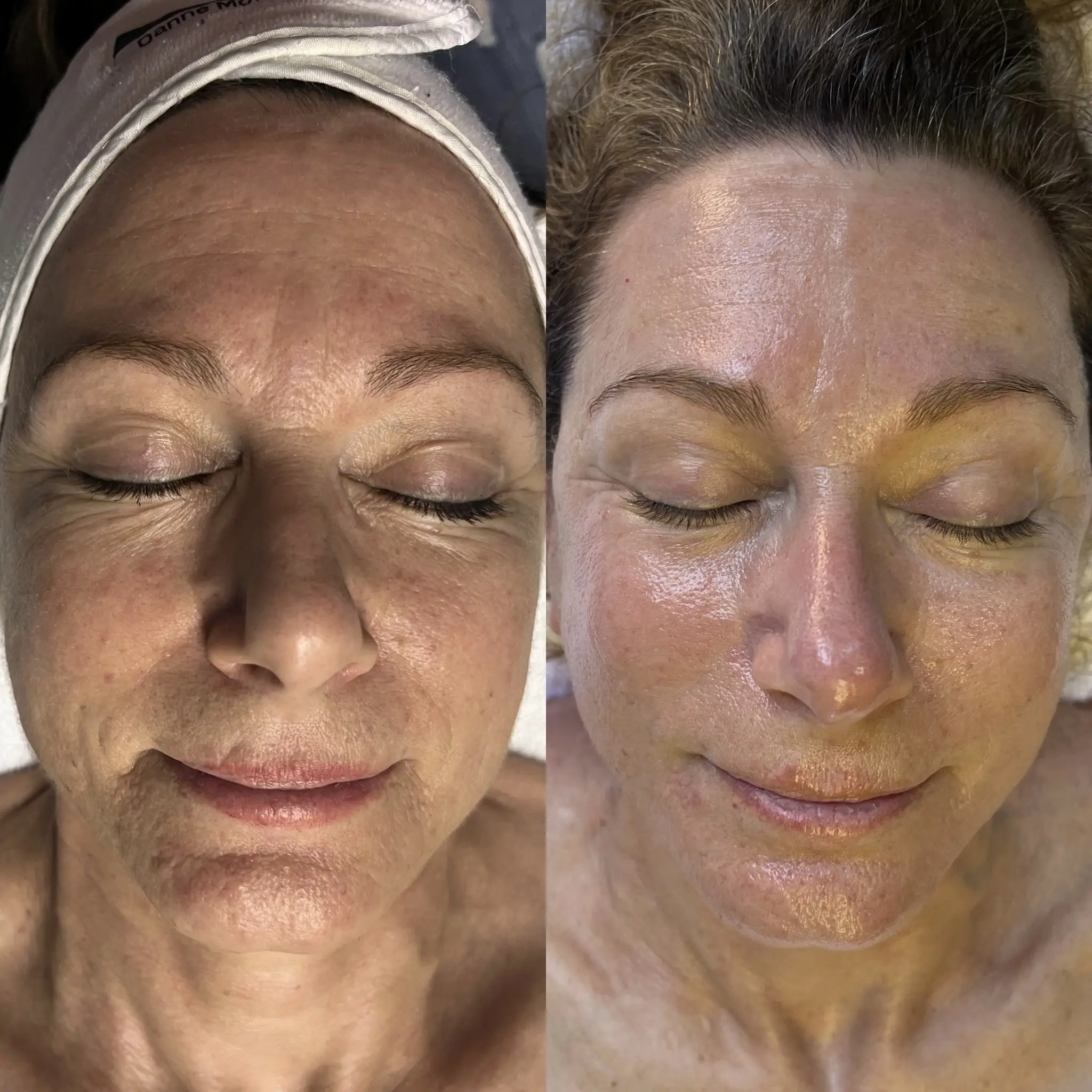 Esthetician Portfolio Photo