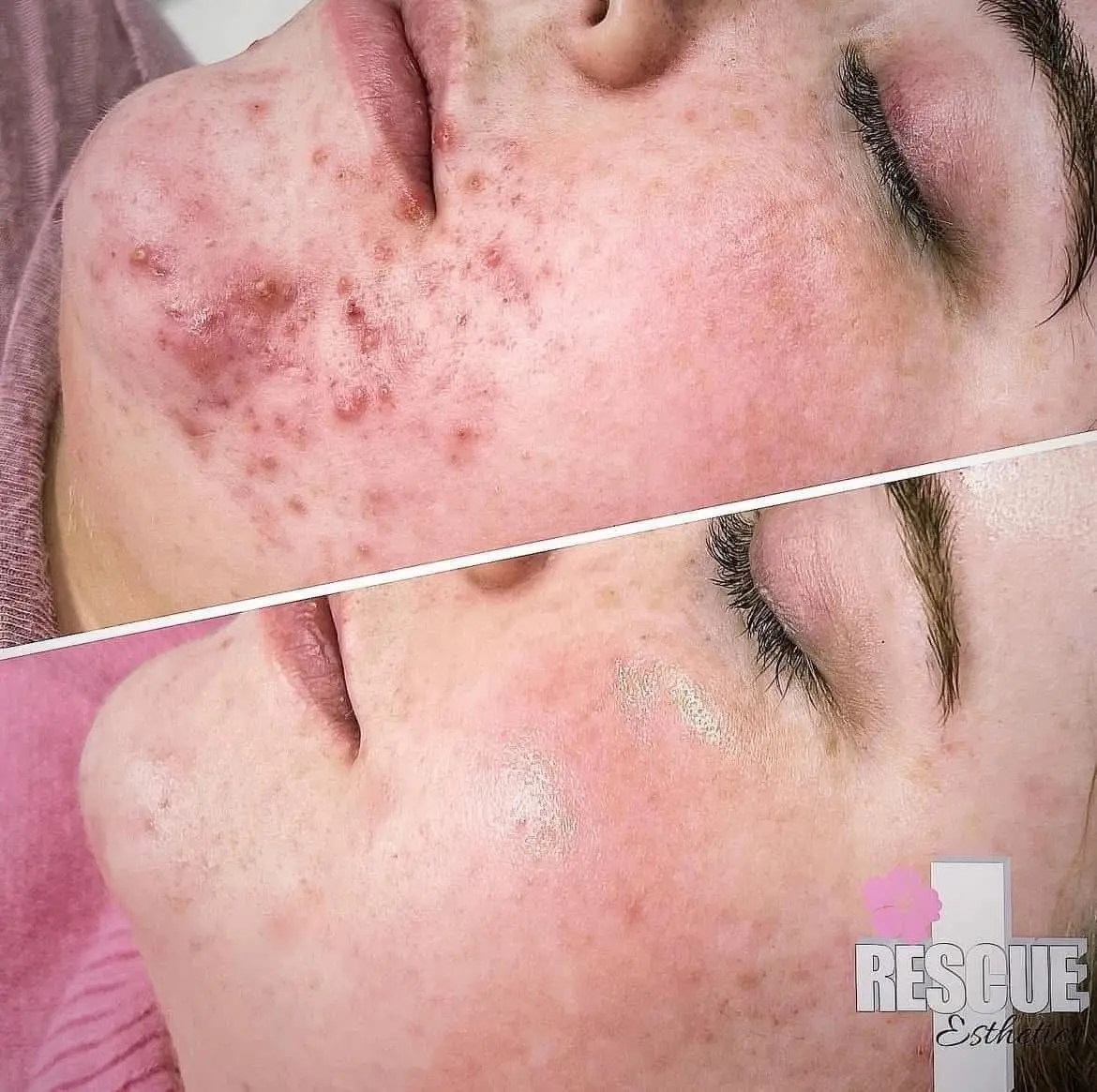 Esthetician Portfolio Photo