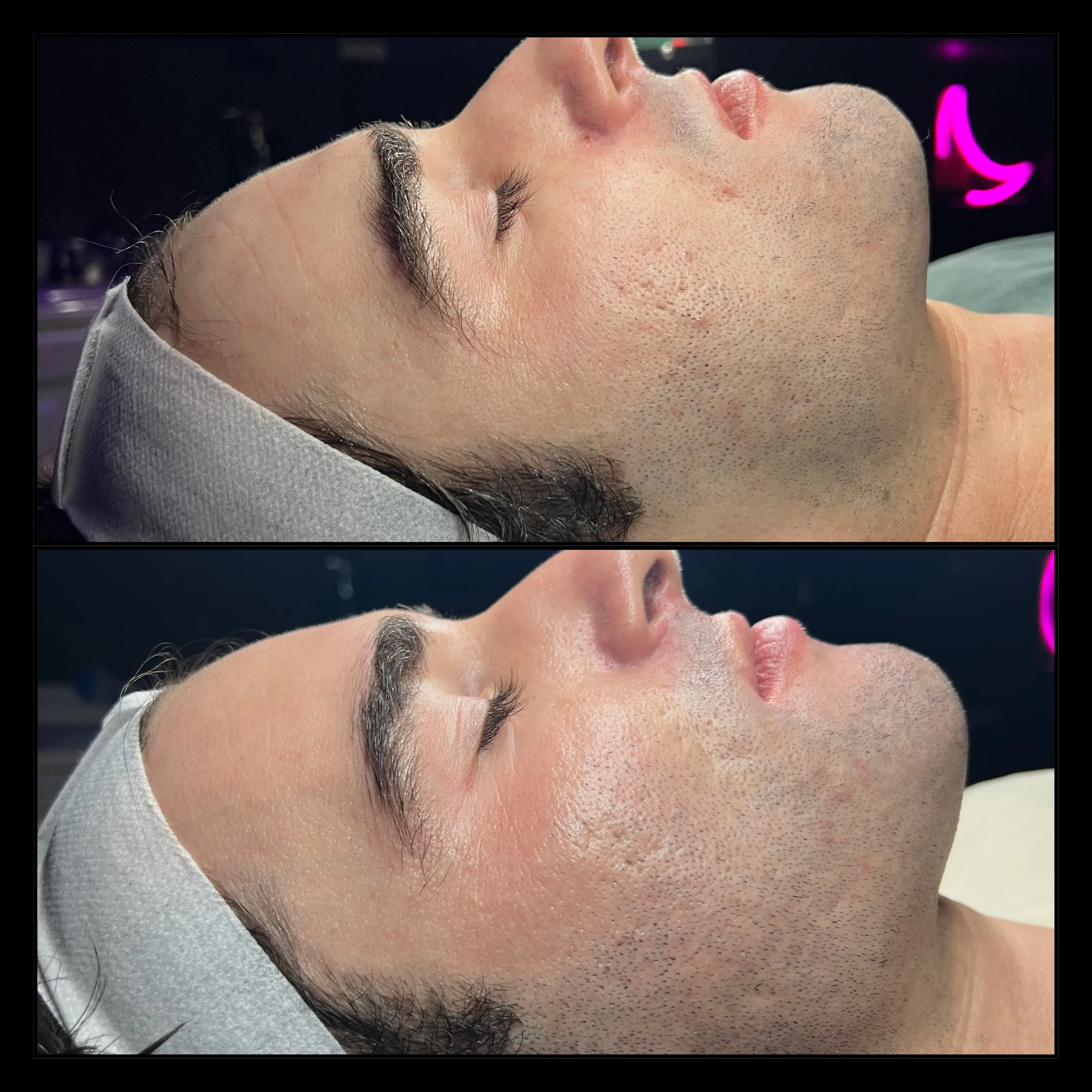 Work by Amethyst Skin Clinic