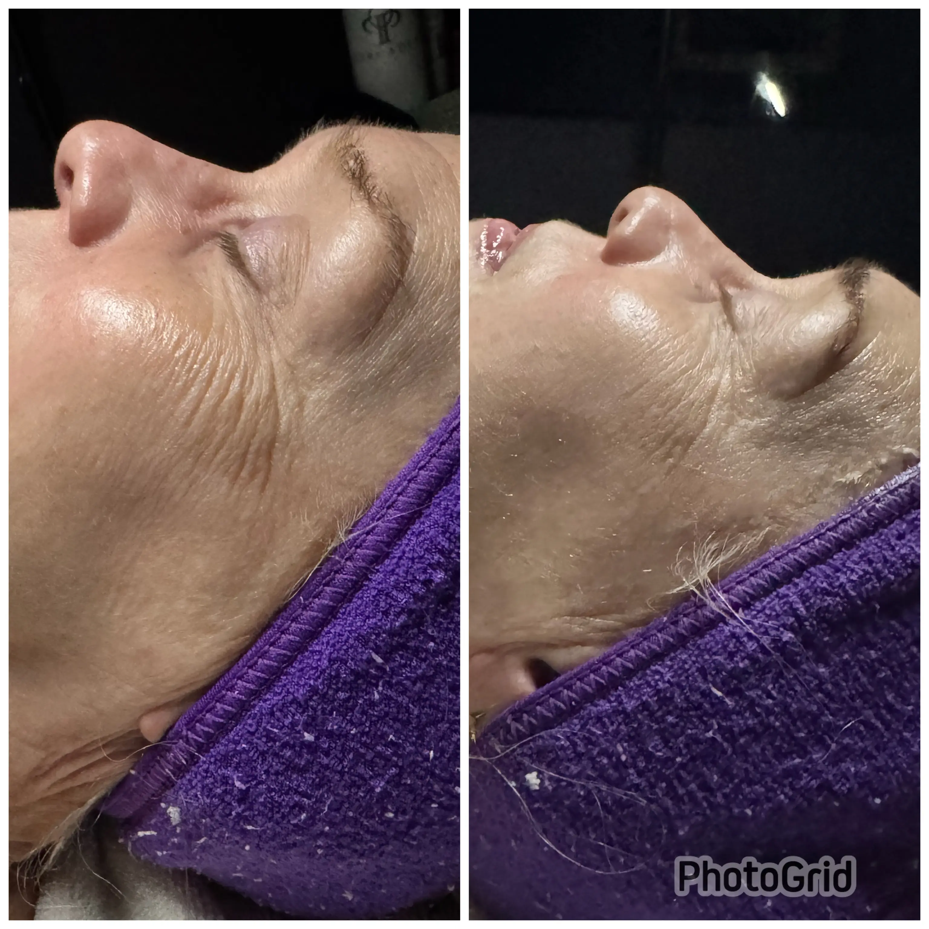 Level 2: Gel Peel Infusion