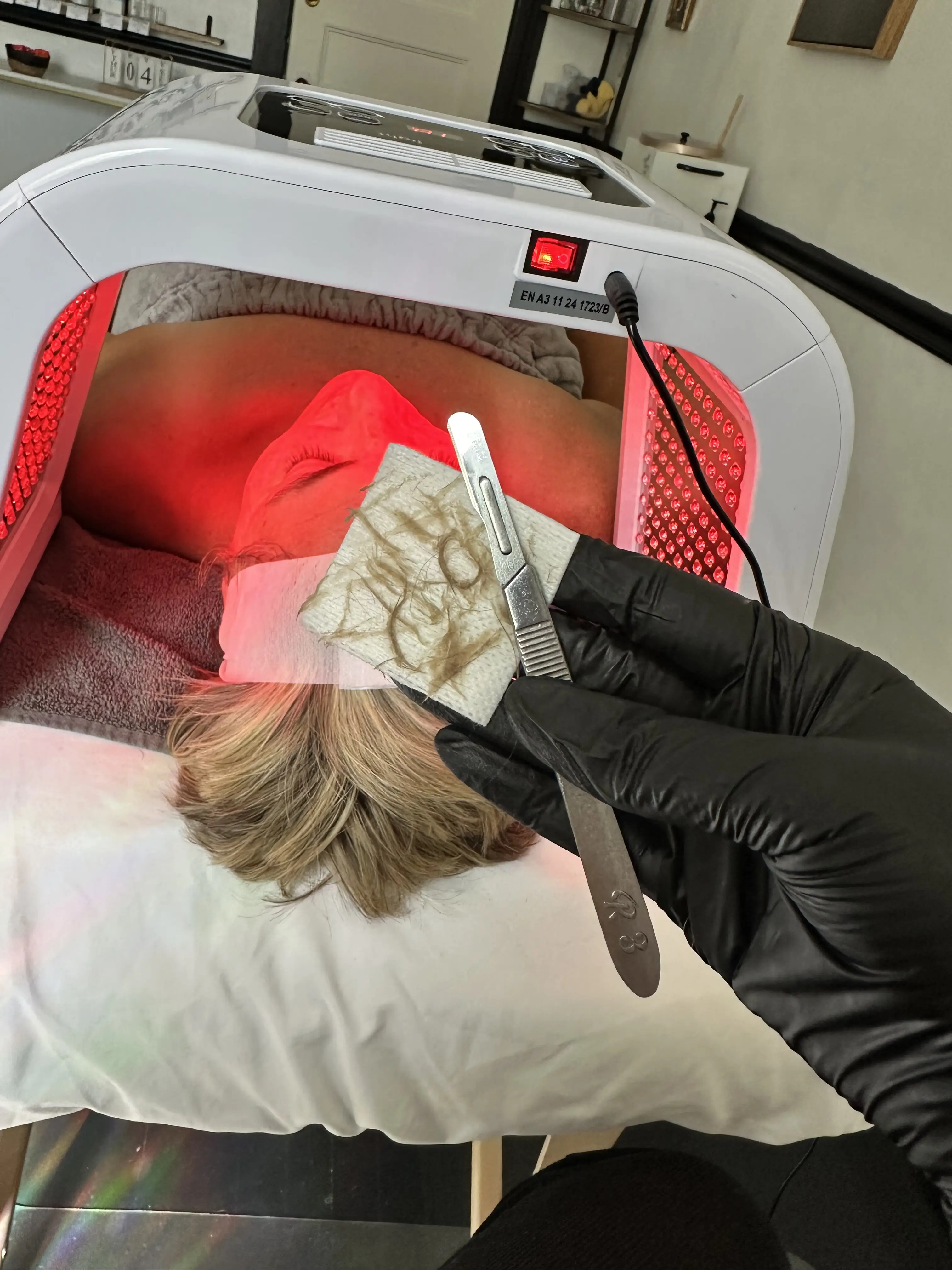 Dermaplaning