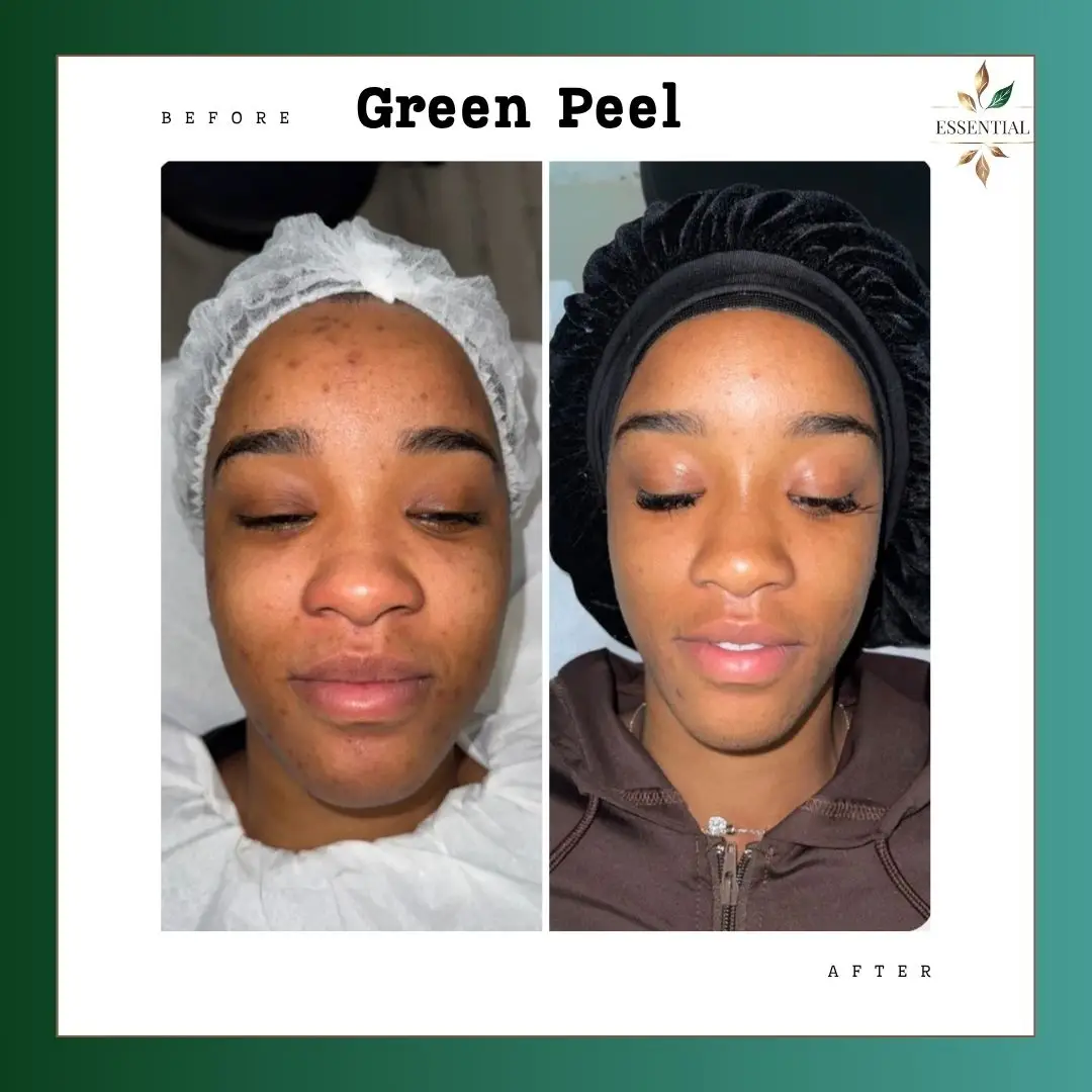 Esthetician Portfolio Photo