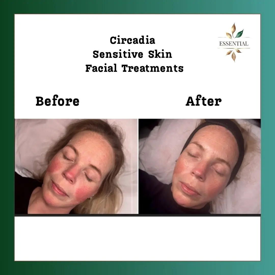 Esthetician Portfolio Photo